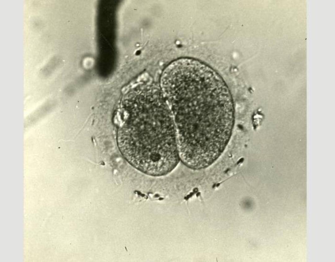 IVF
