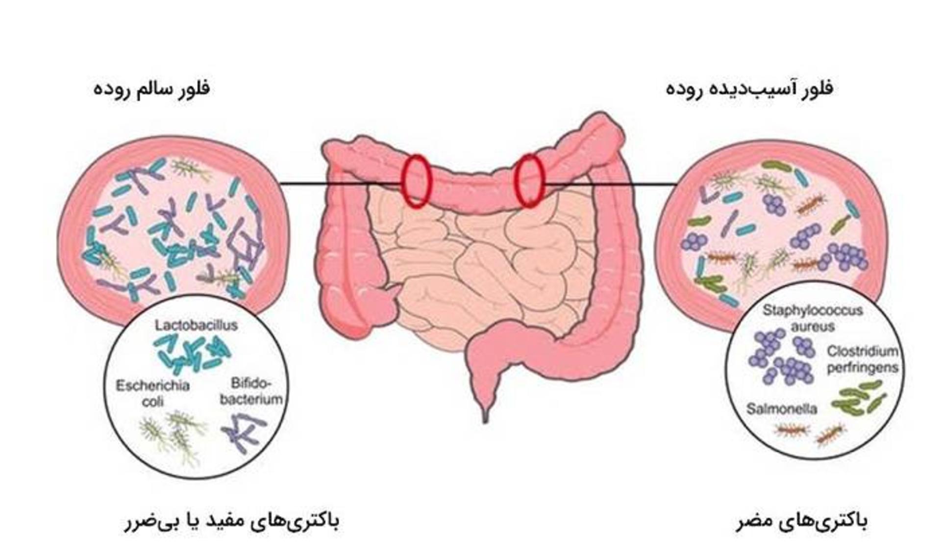 میکروبیوم 