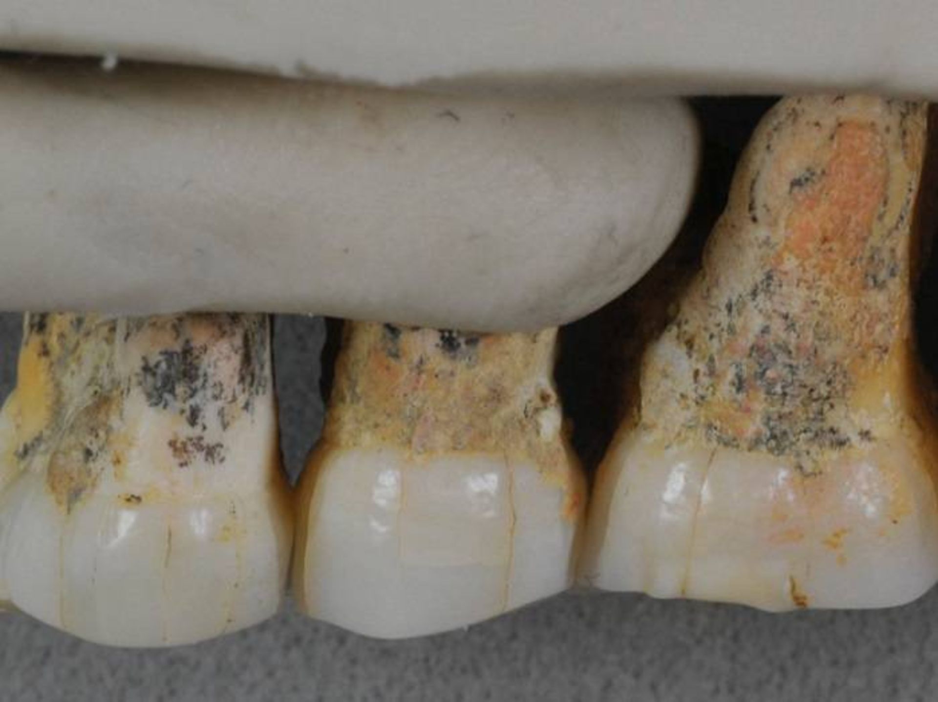 مرجع متخصصين ايران دندان انسان باستاني