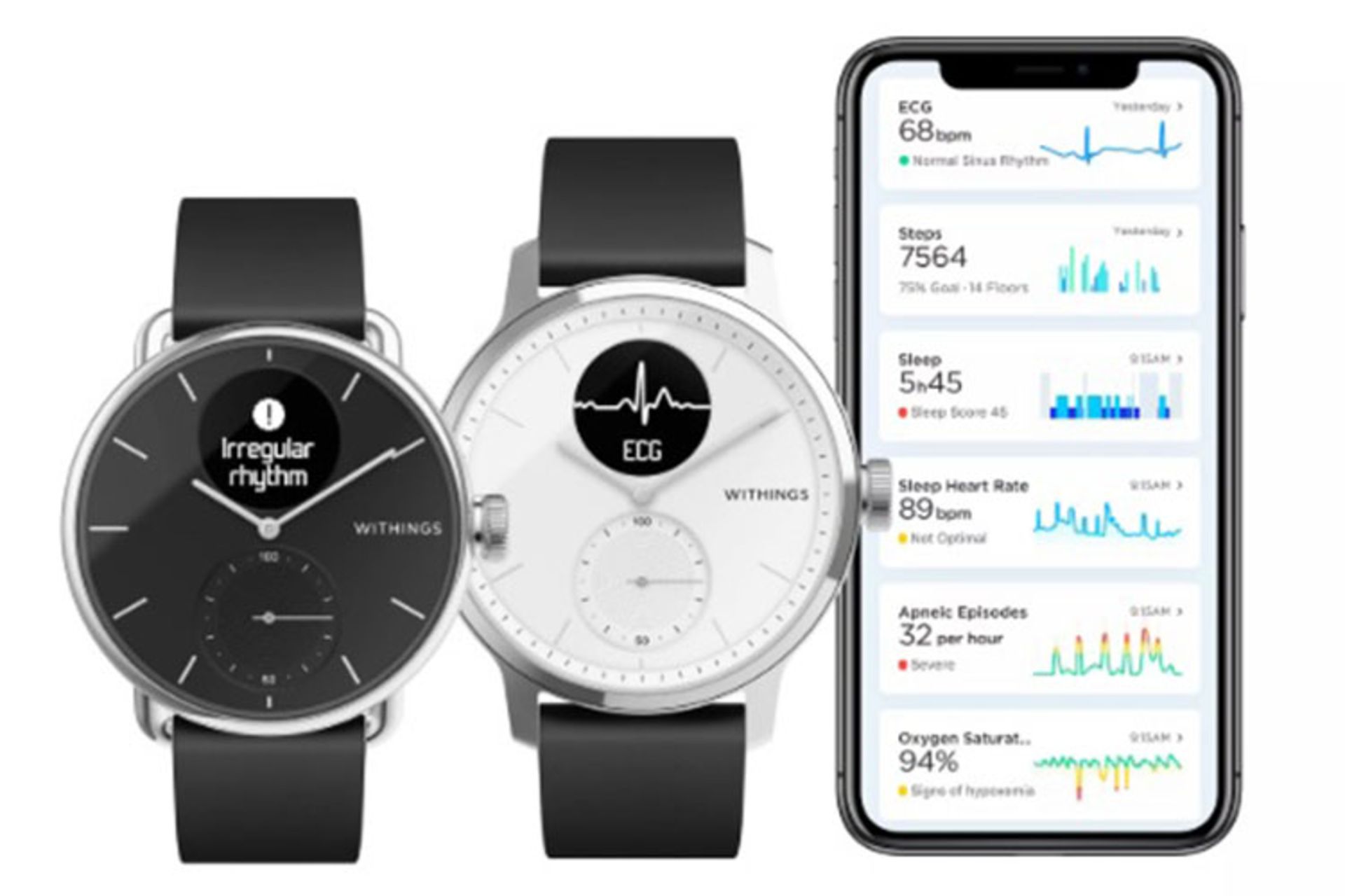 ScanWatch 