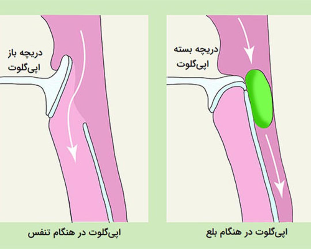  اپی‌گلوت