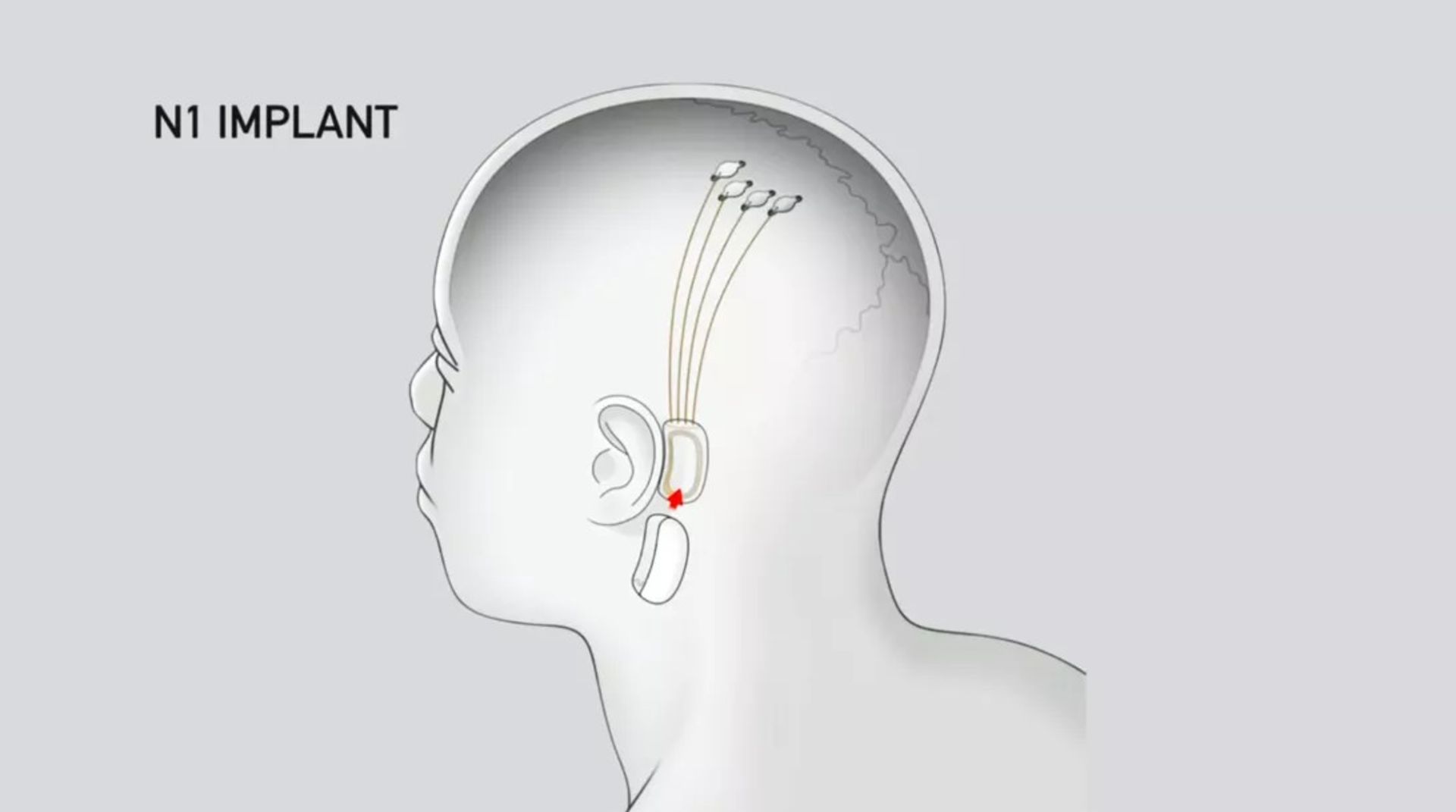 Neuralink / نورالینک
