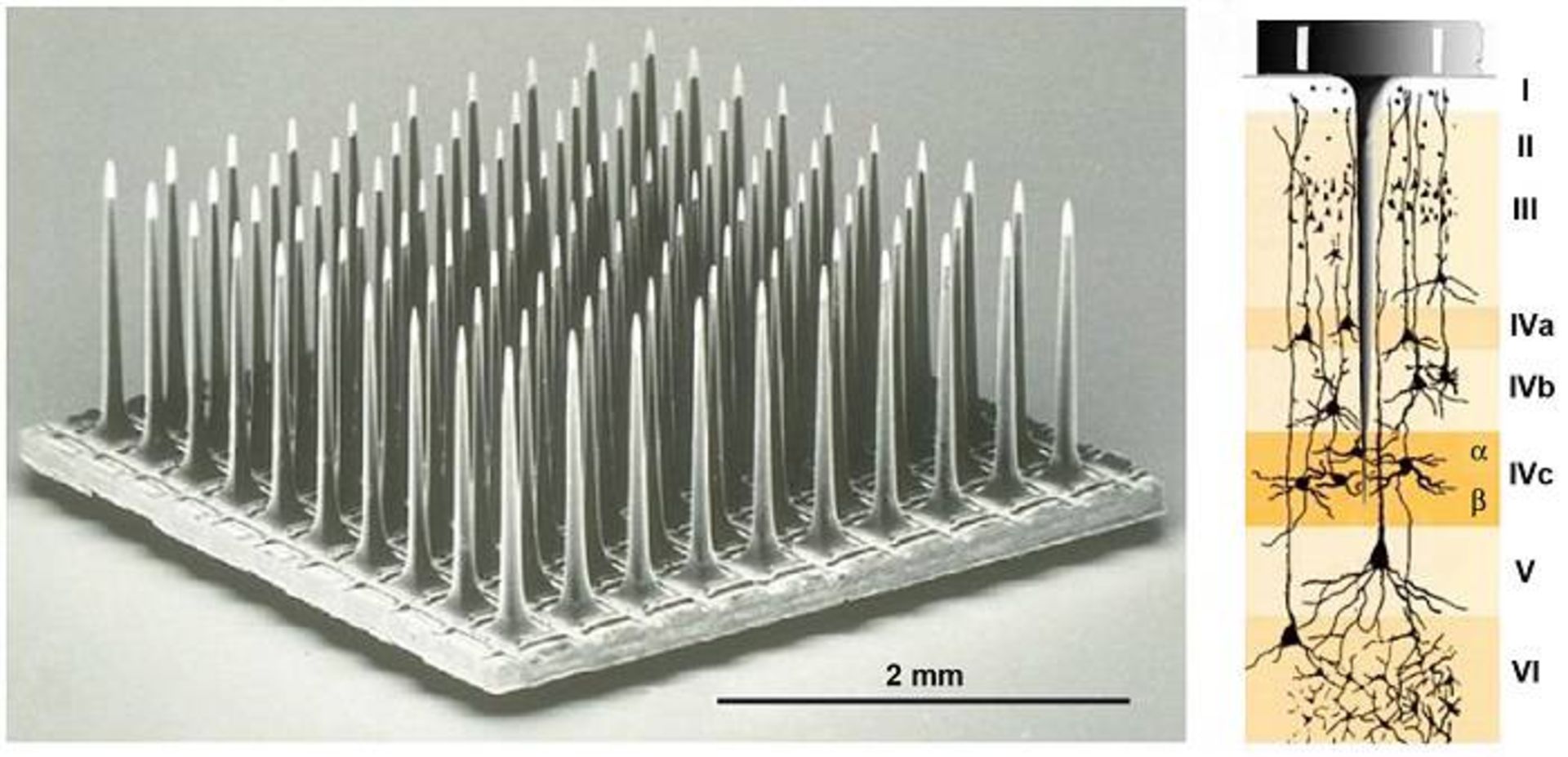 ایمپلنت حاوی الکترون 