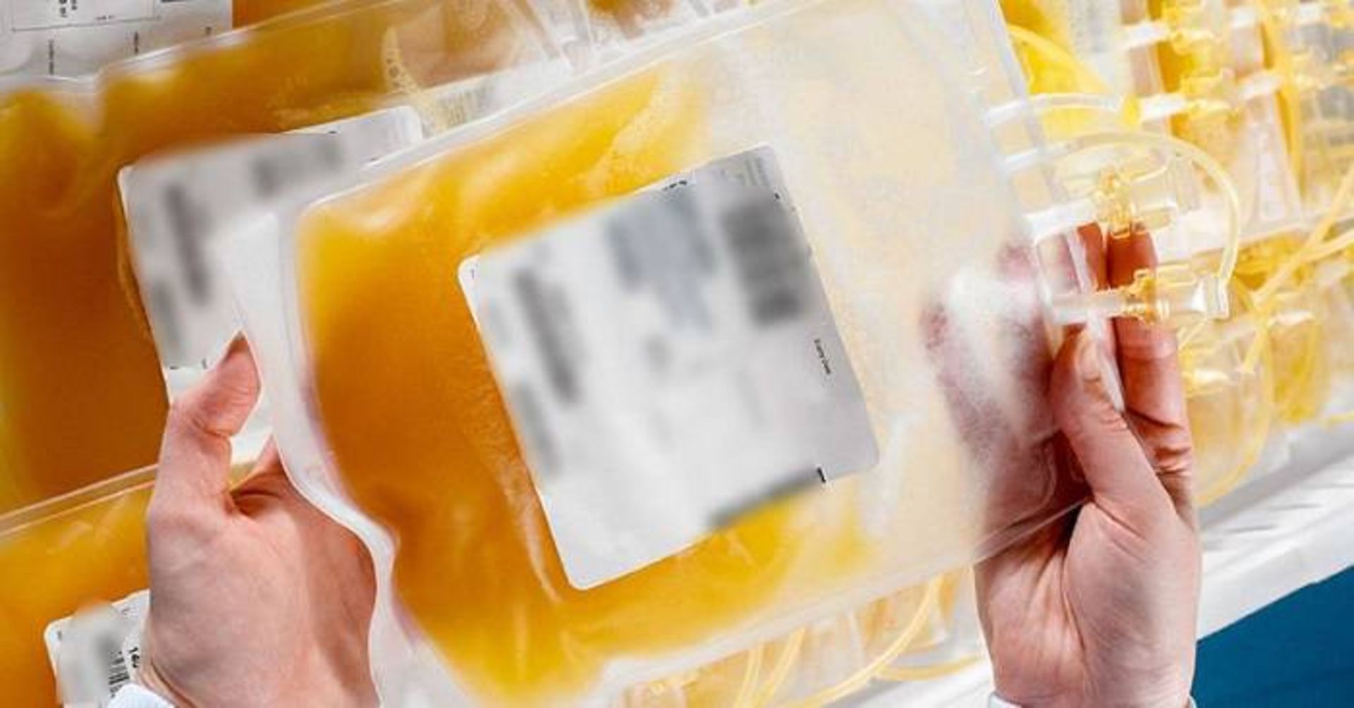 پلاسمای خون