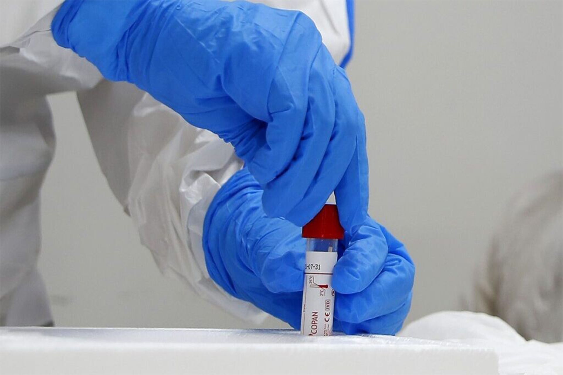 کرونا / coronavirus