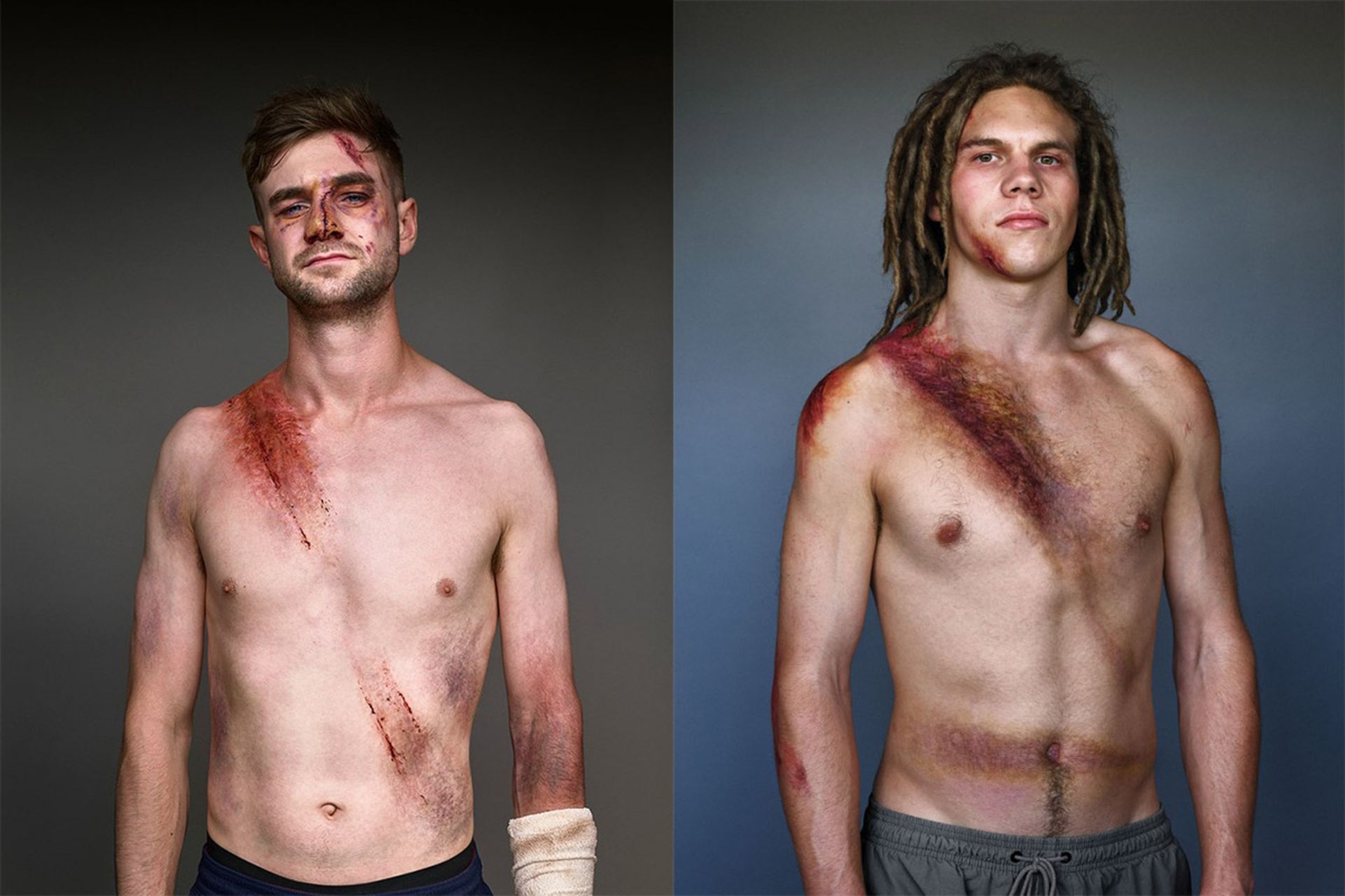 تصادف با کمربند ایمنی