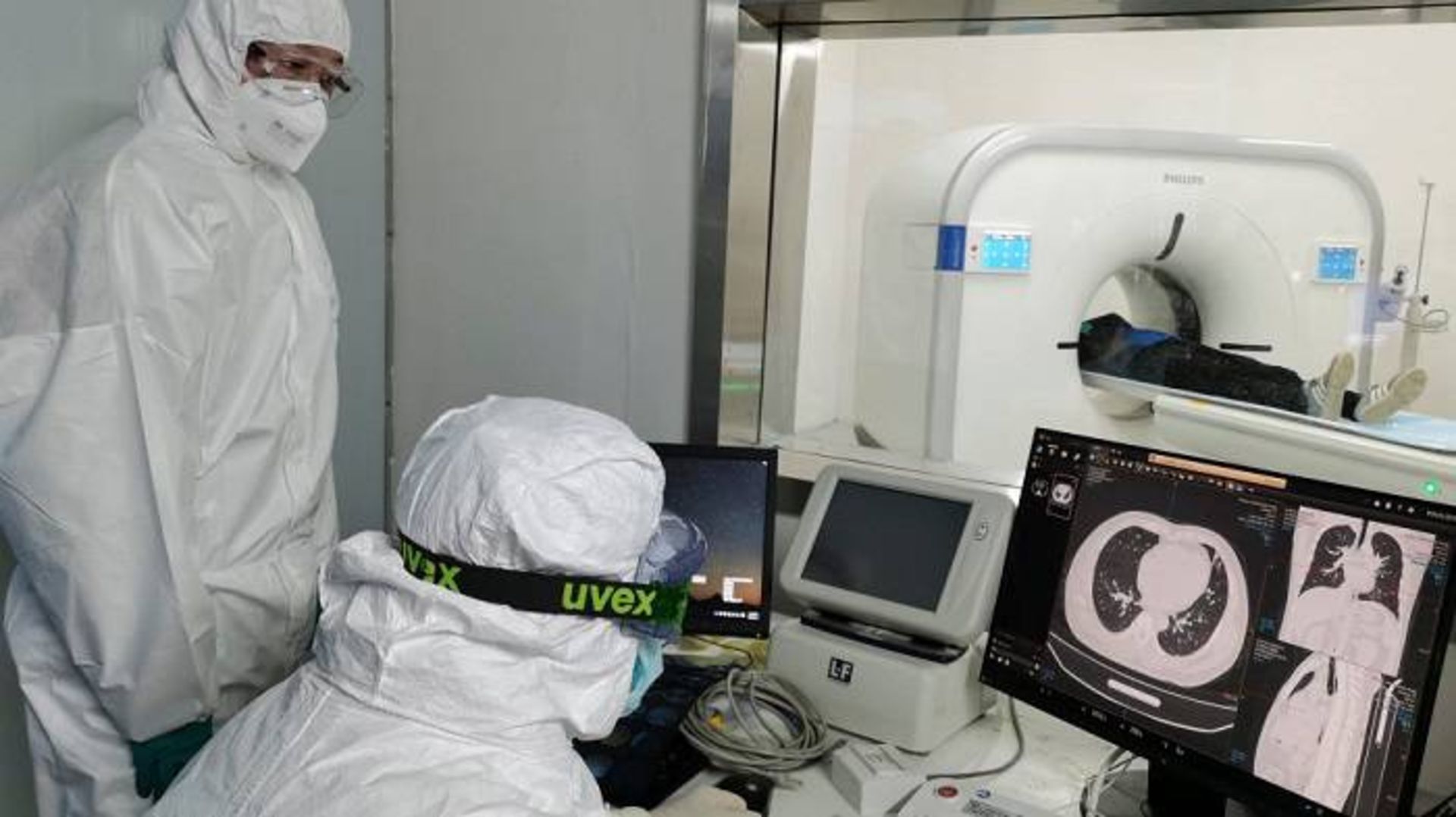 پزشکان کرونا اسکن ریه