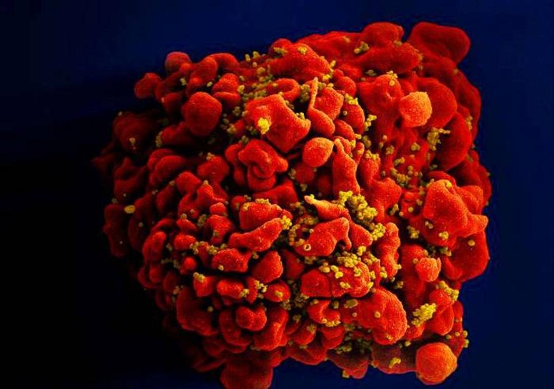 ویروس HIV