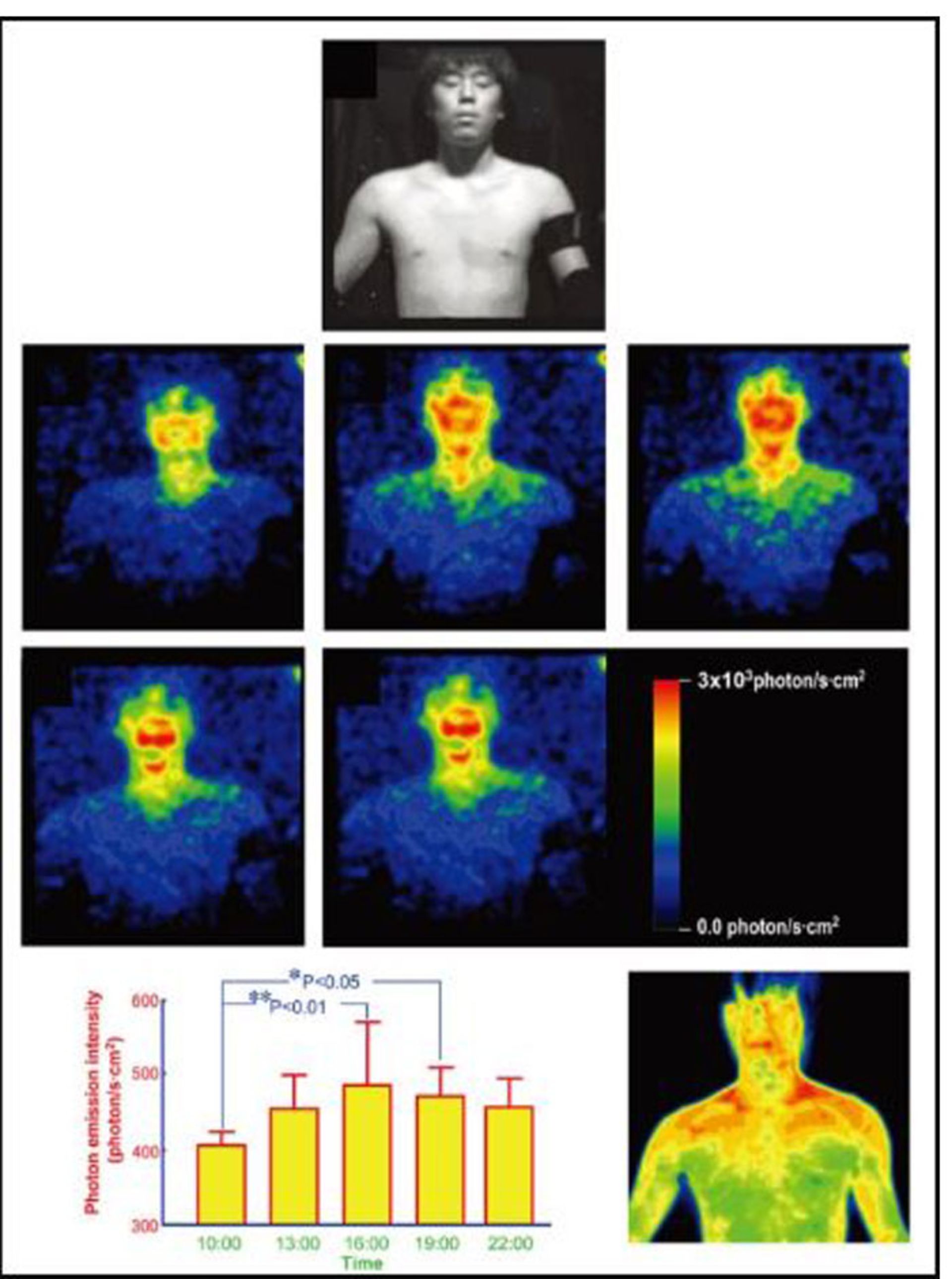 مرجع متخصصين ايران عكاسي بيولومينسانس از بدن انسان با يك دوربين فوق حساس