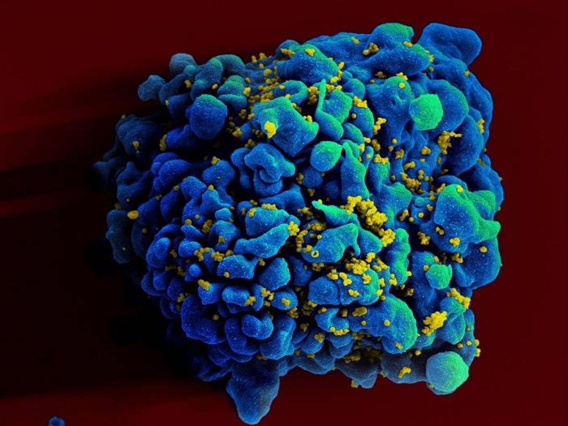مرجع متخصصين ايران سلول انساني آلوده به ويروس HIV