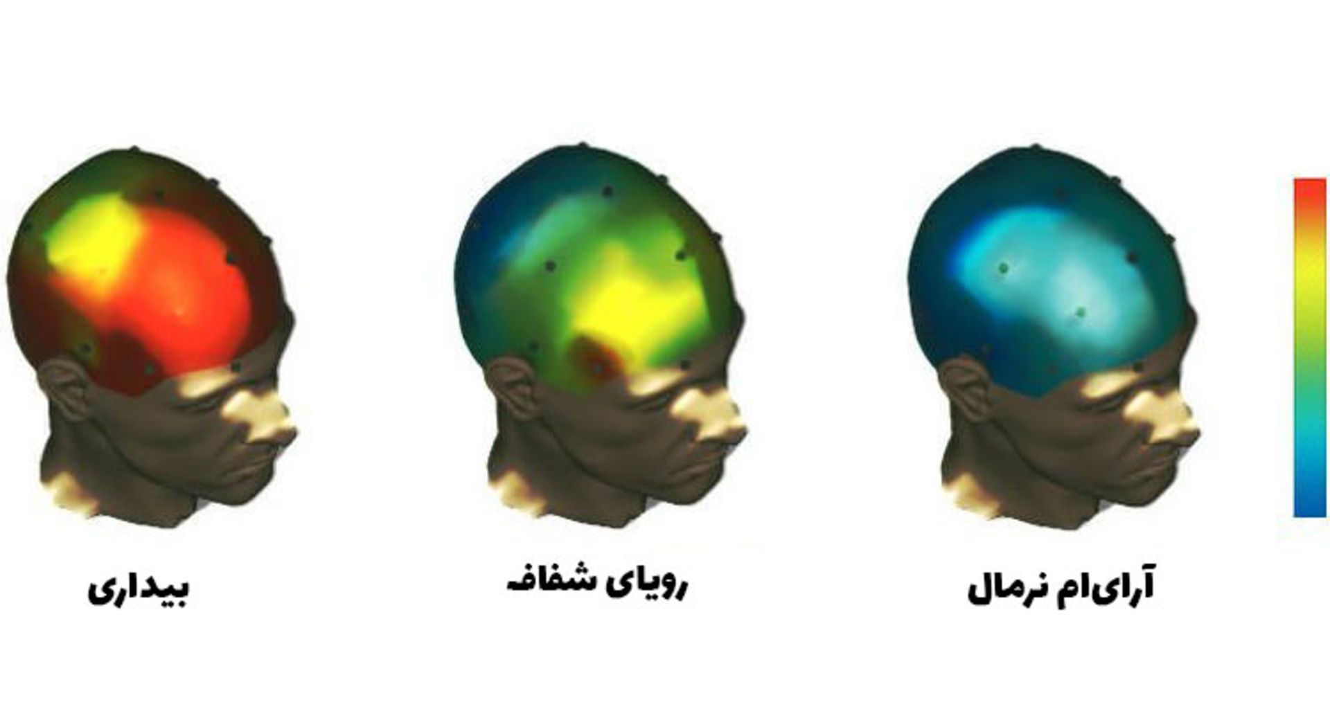 کارکرد مغز هنگام رویای شفاف