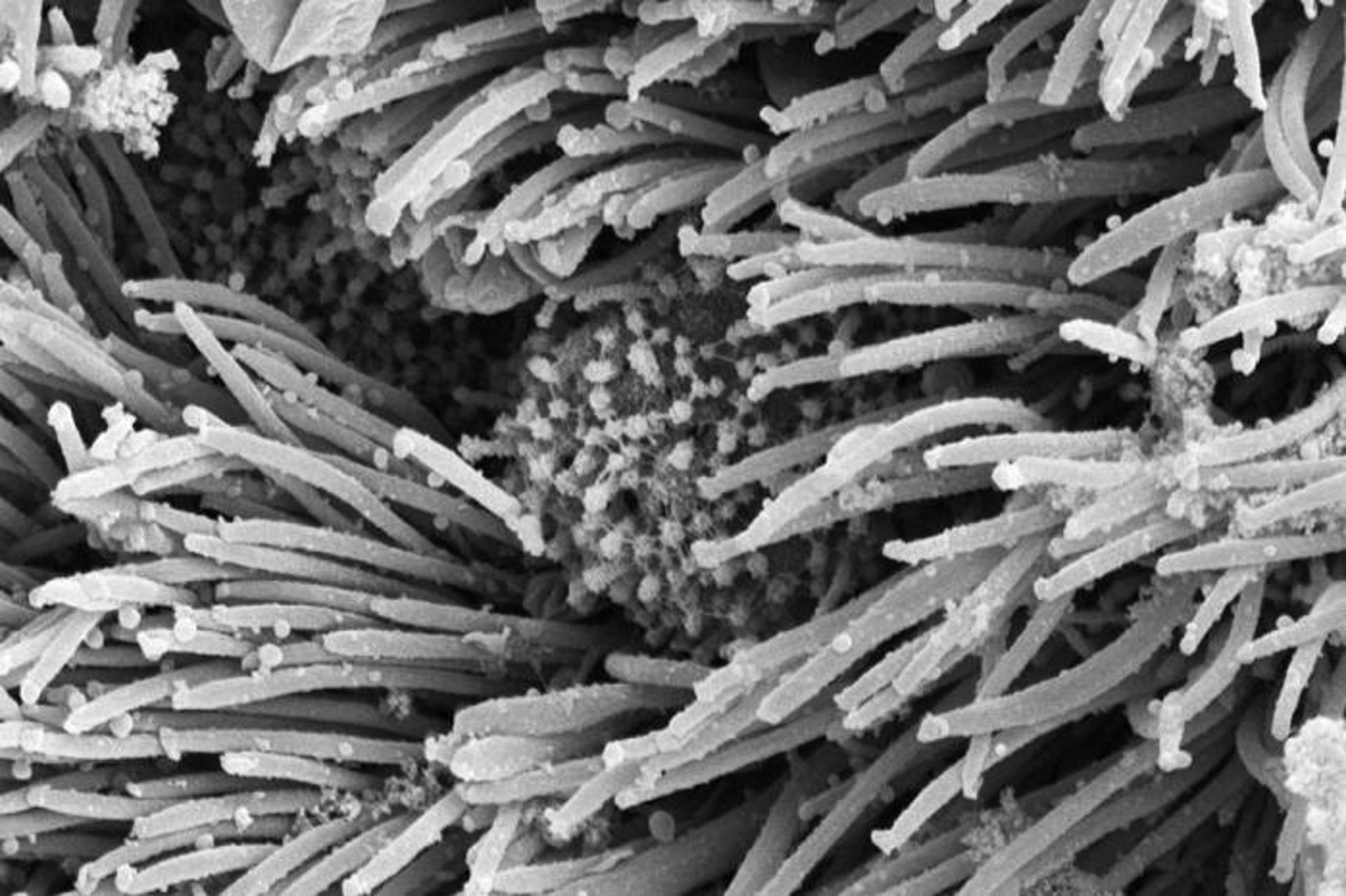 بافت پوششی آلوده به کرونا / nasal tissue infected with coronavirus