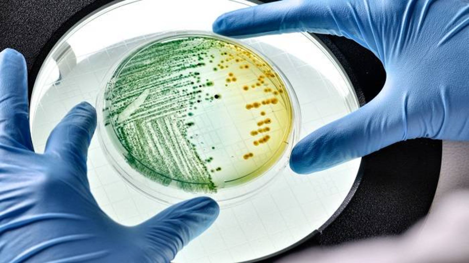 مرجع متخصصين ايران باكتري اشريشيا كلي / Escherichia coli bacteria 