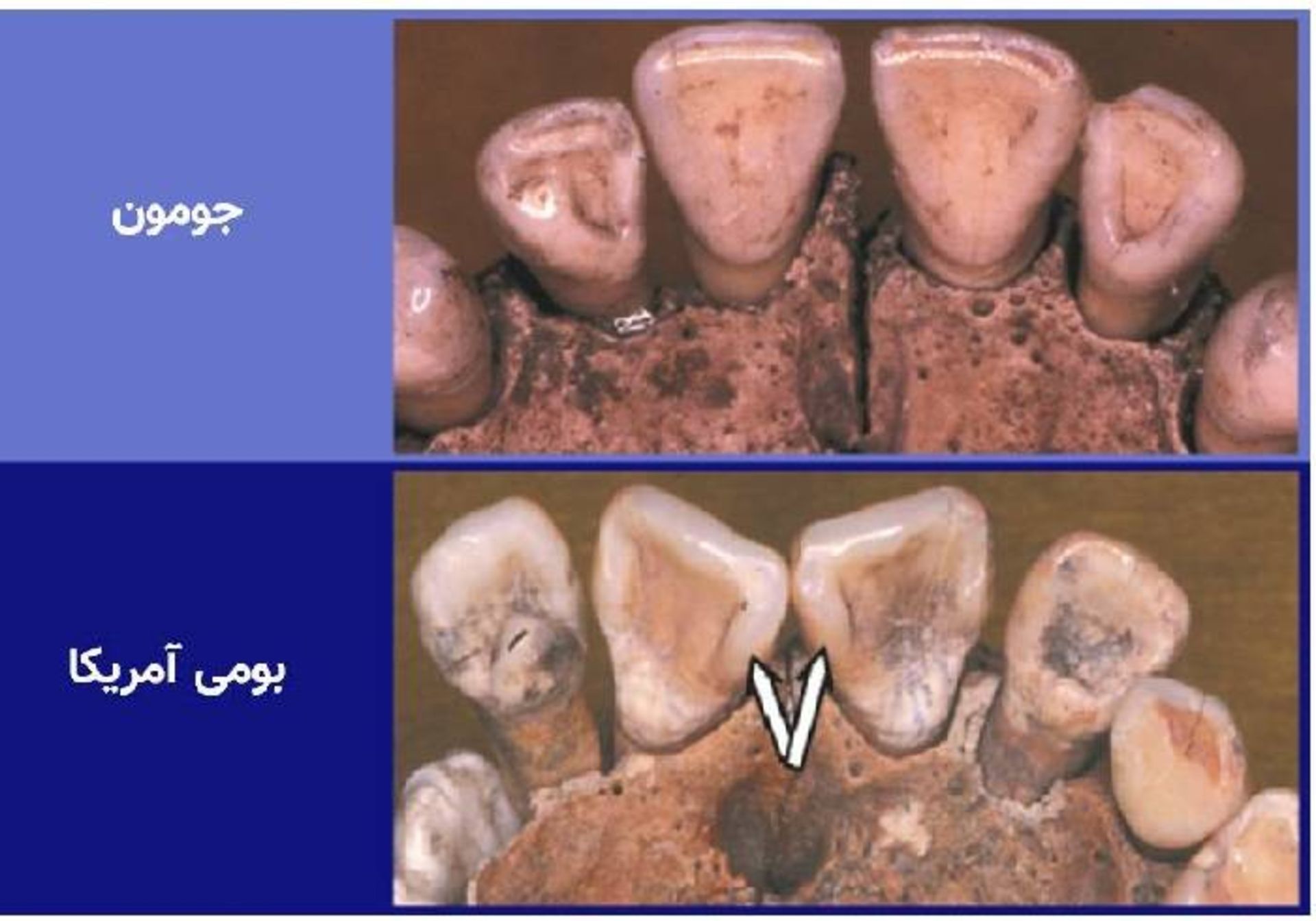 مقایسه دندان مردم جومون و بومی های آمریکا