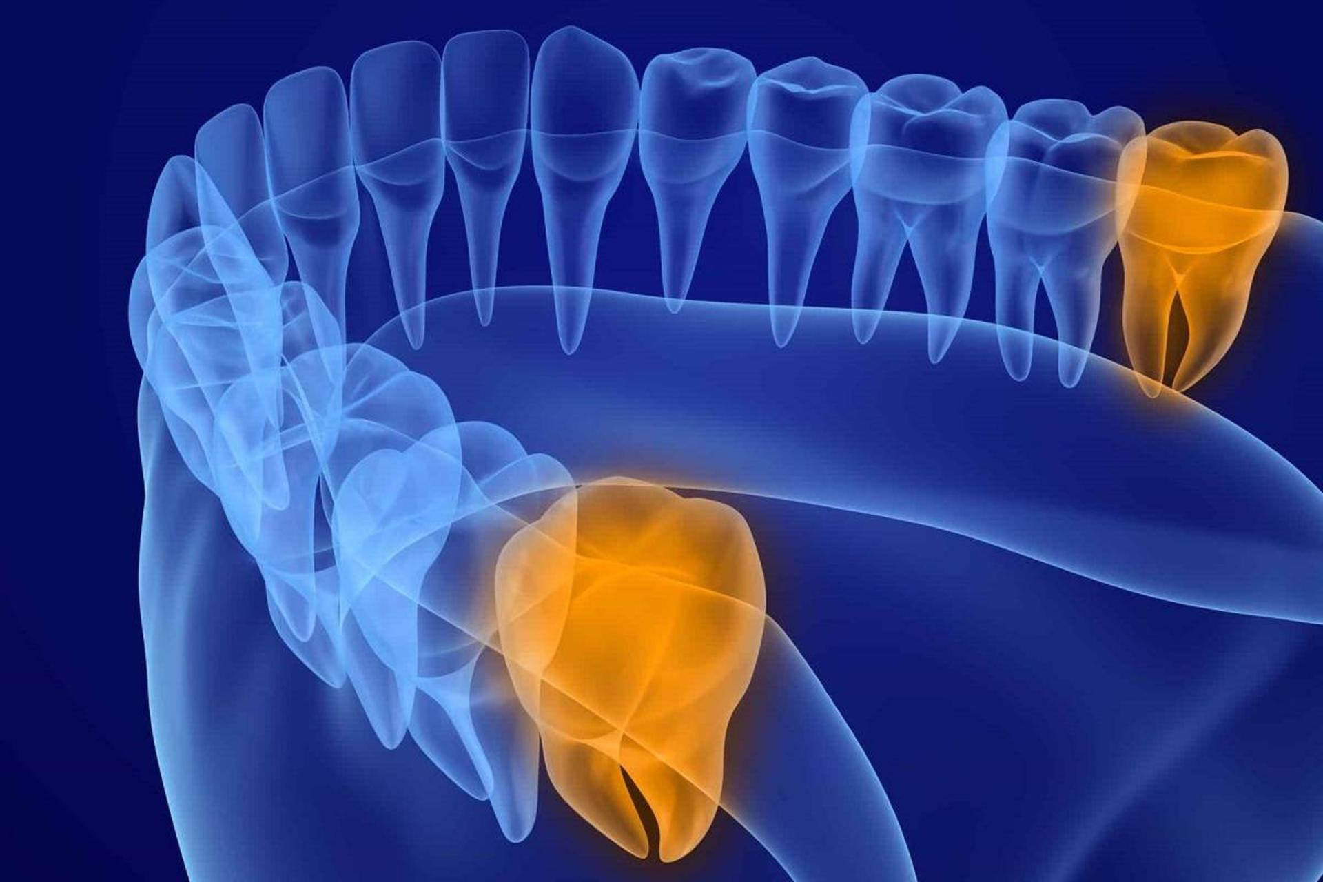 دانشمندان سرانجام دریافتند چرا دندان‌های عقل در بزرگسالی ظاهر می‌شوند