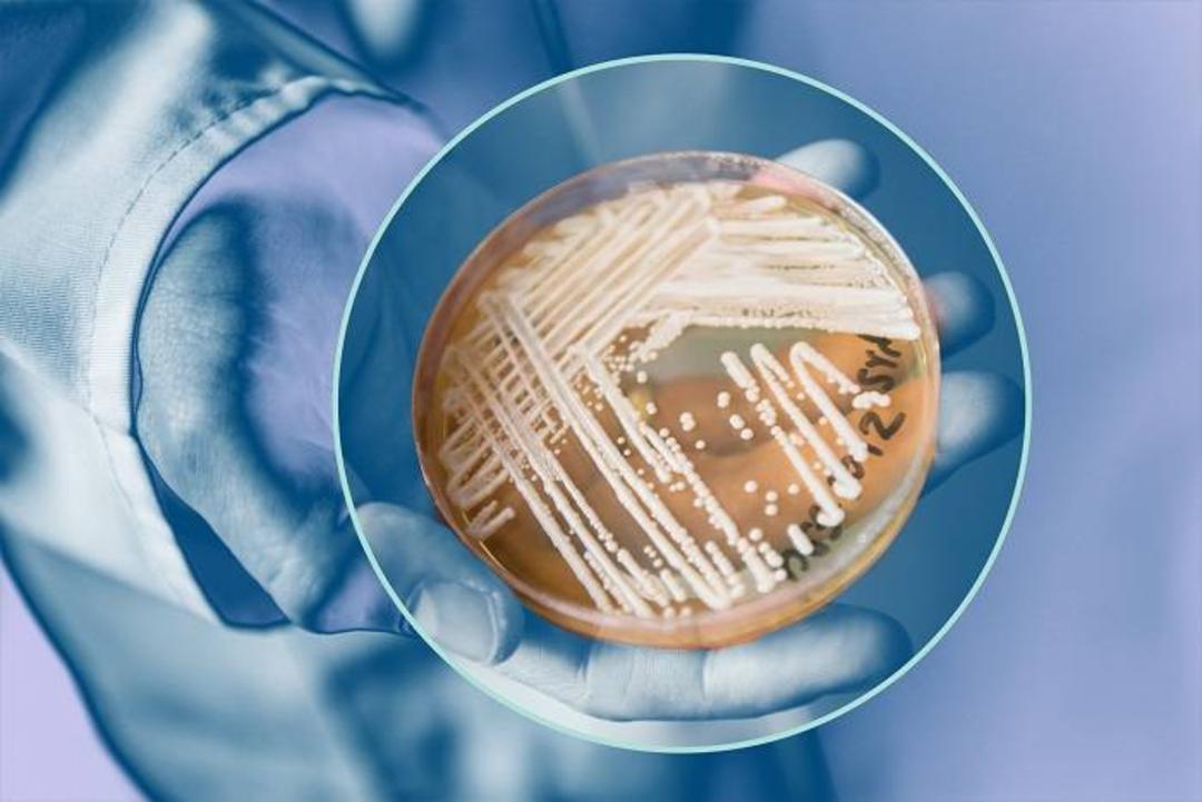 قارچ کشت شده در آزمایشگاه / Fungal culture
