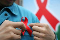 شناسایی دومین بیمار HIV که بدون مداخله پزشکی از ویروس ایدز رهایی یافت