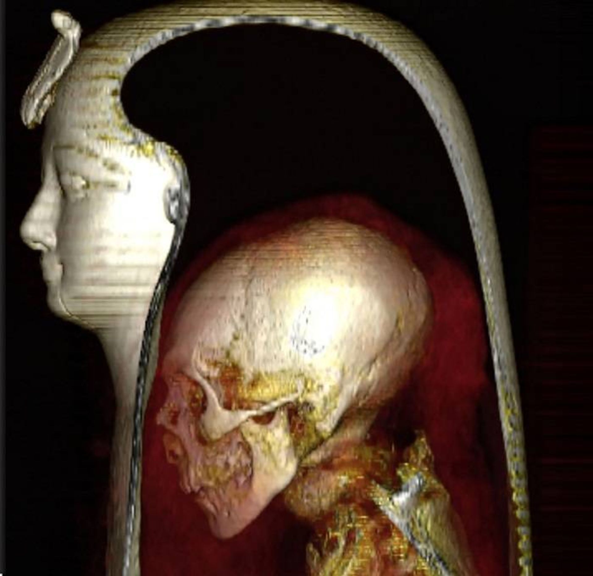 جمجمه و اسکلت زیر مومیایی فرعون / mummy