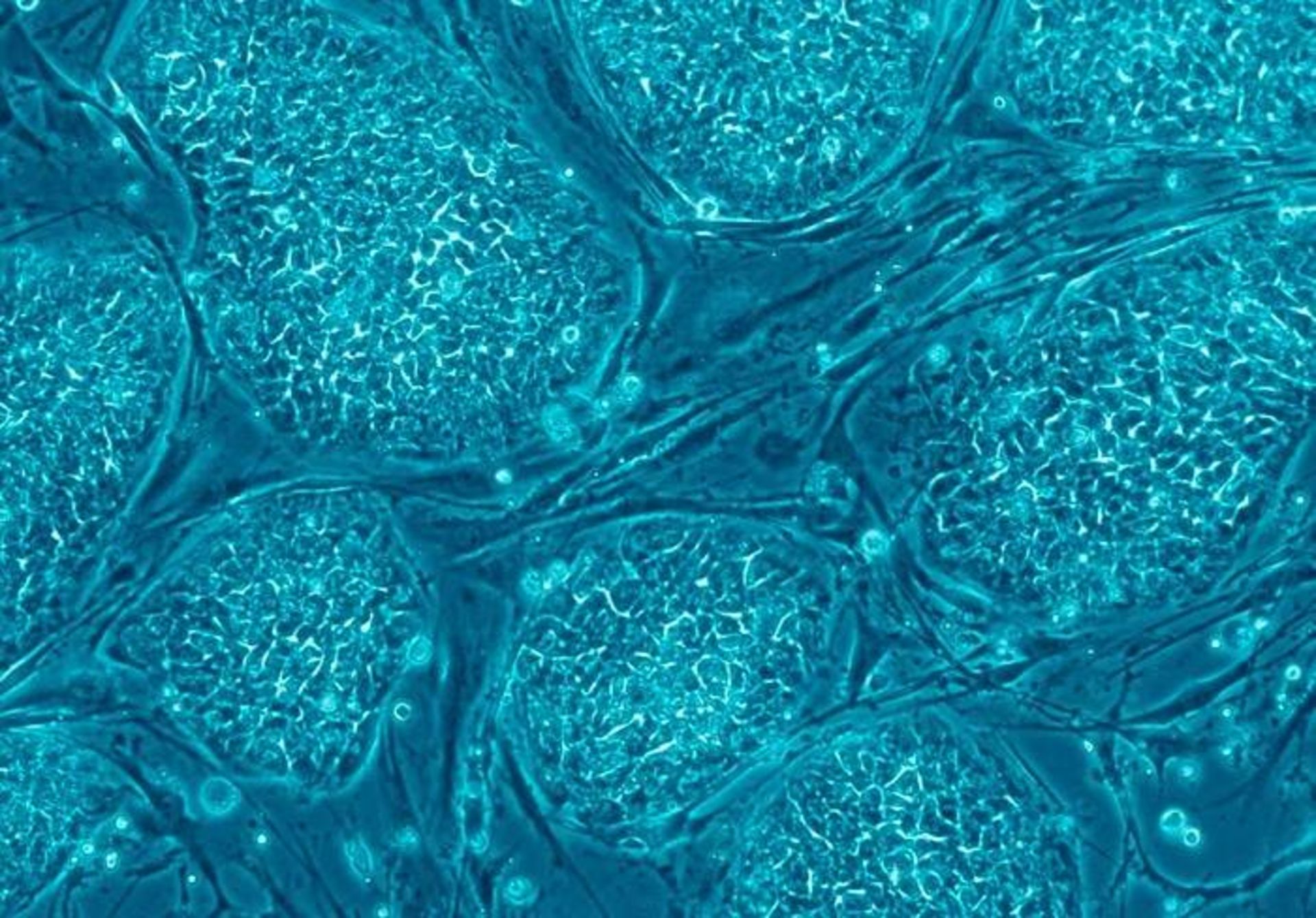 سلول های بنیادی رویانی انسان / Human embryonic stem cells