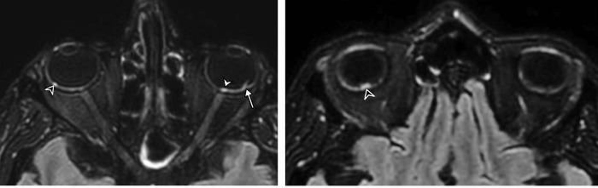 اسکن بیمار کووید /  covid patient scan