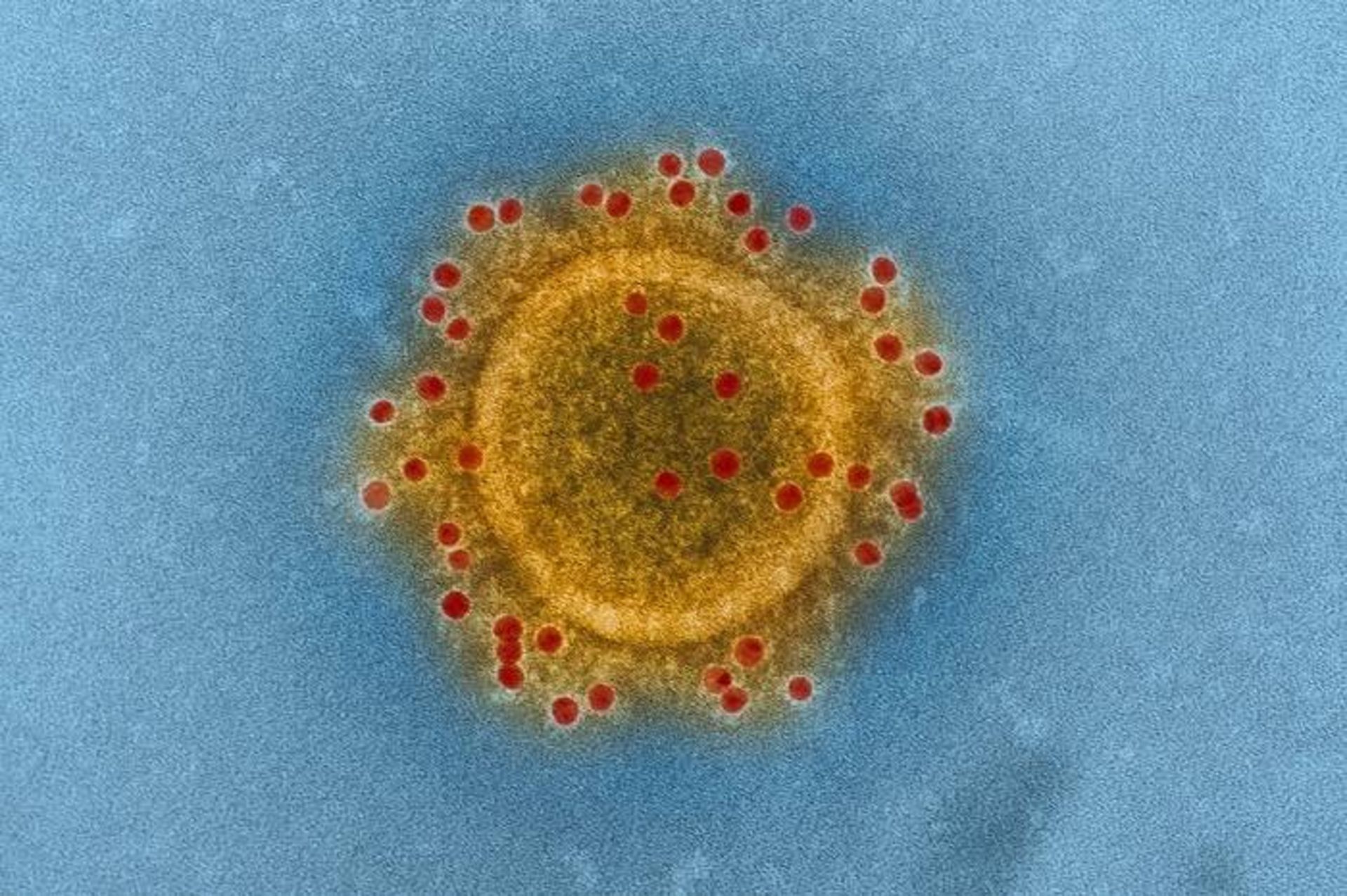 مرجع متخصصين ايران ويروس مرس / MERS virus