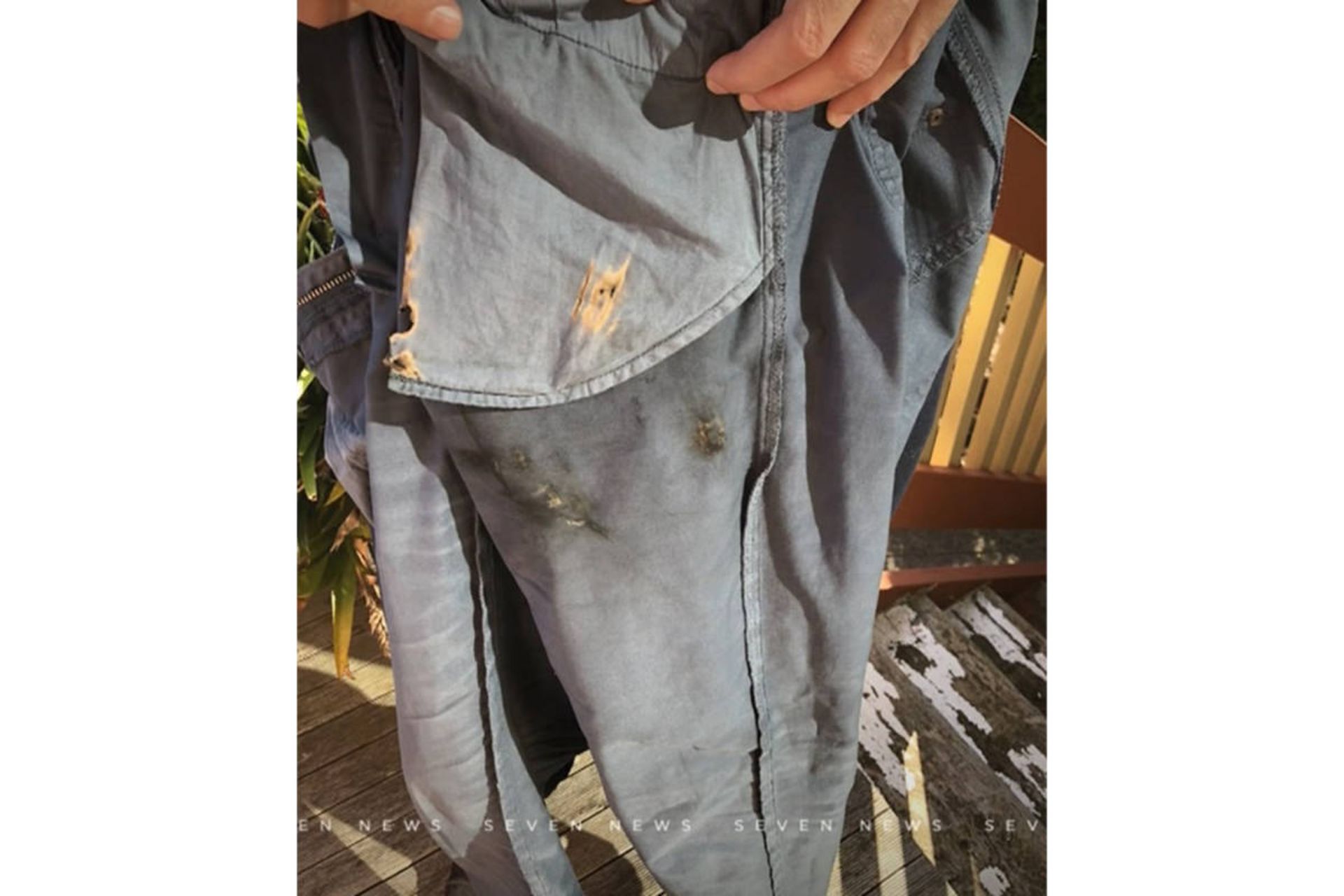 جیب سوخته شده لباس مرد استرالیایی در پی انفجار آیفون X اپل