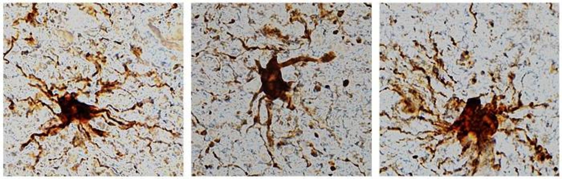 سلول‌ های گلیال پس از مرگ