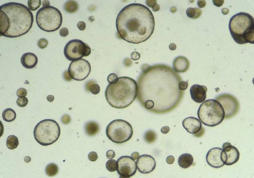 ارگانوئید غده اشکی چشم / tear glands organoids