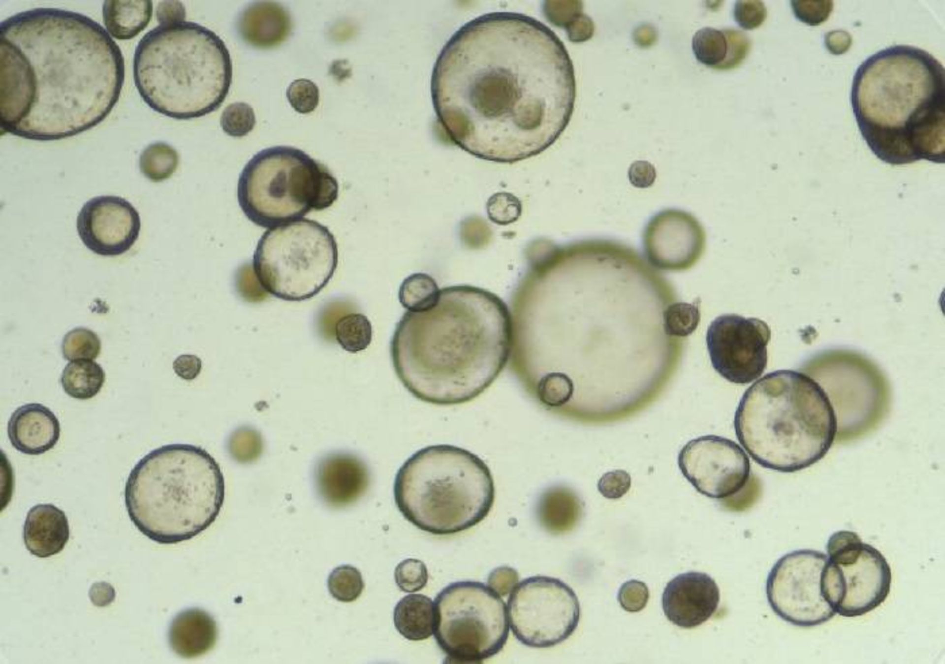 ارگانوئید غده اشکی چشم / tear glands organoids