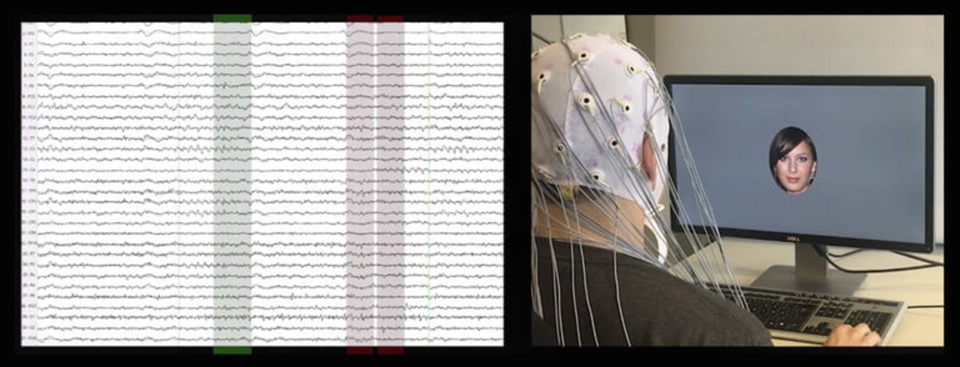 هوش مصنوعی خوانش مغز