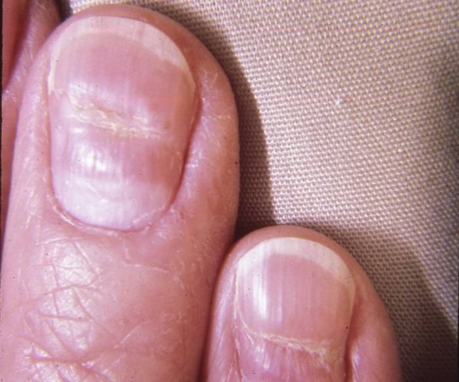 خطوط بیو ناخن