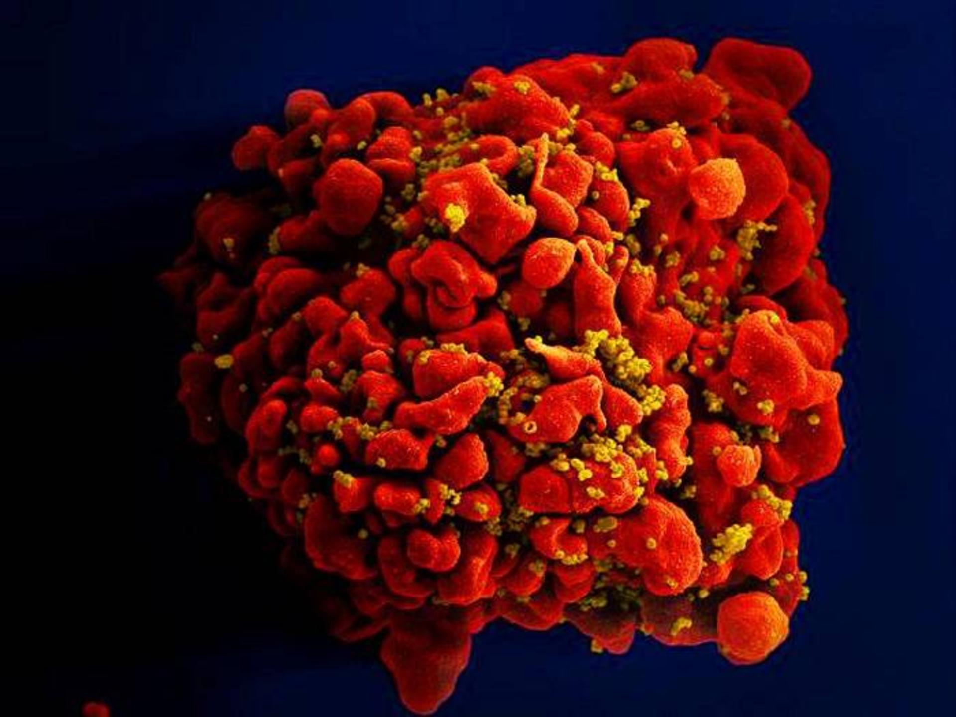 ویروس HIV