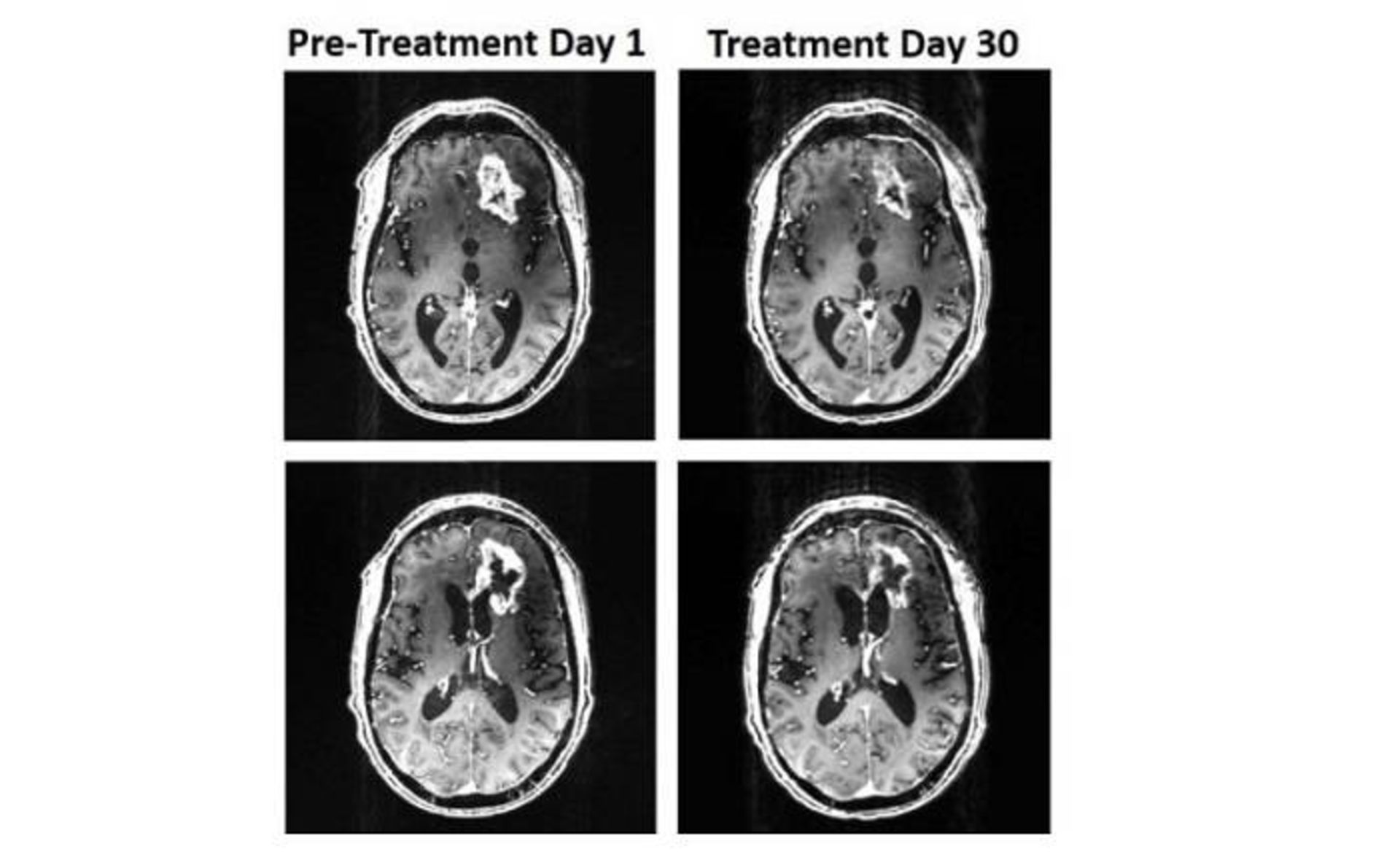 اسکن مغز  / brain scans
