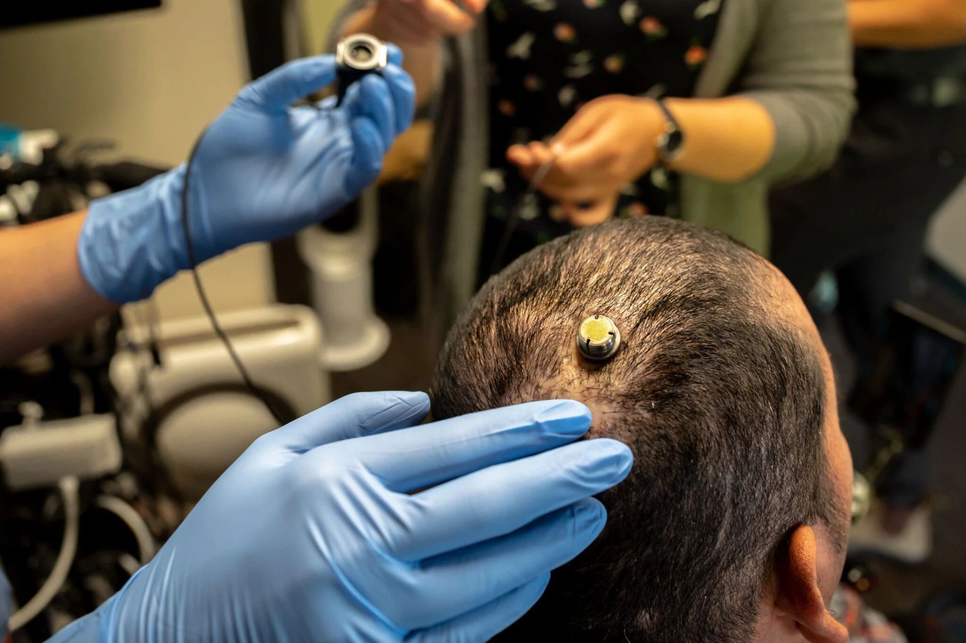 اتصال کابل به درگاه الکترودهای کاشته‌شده در مغز