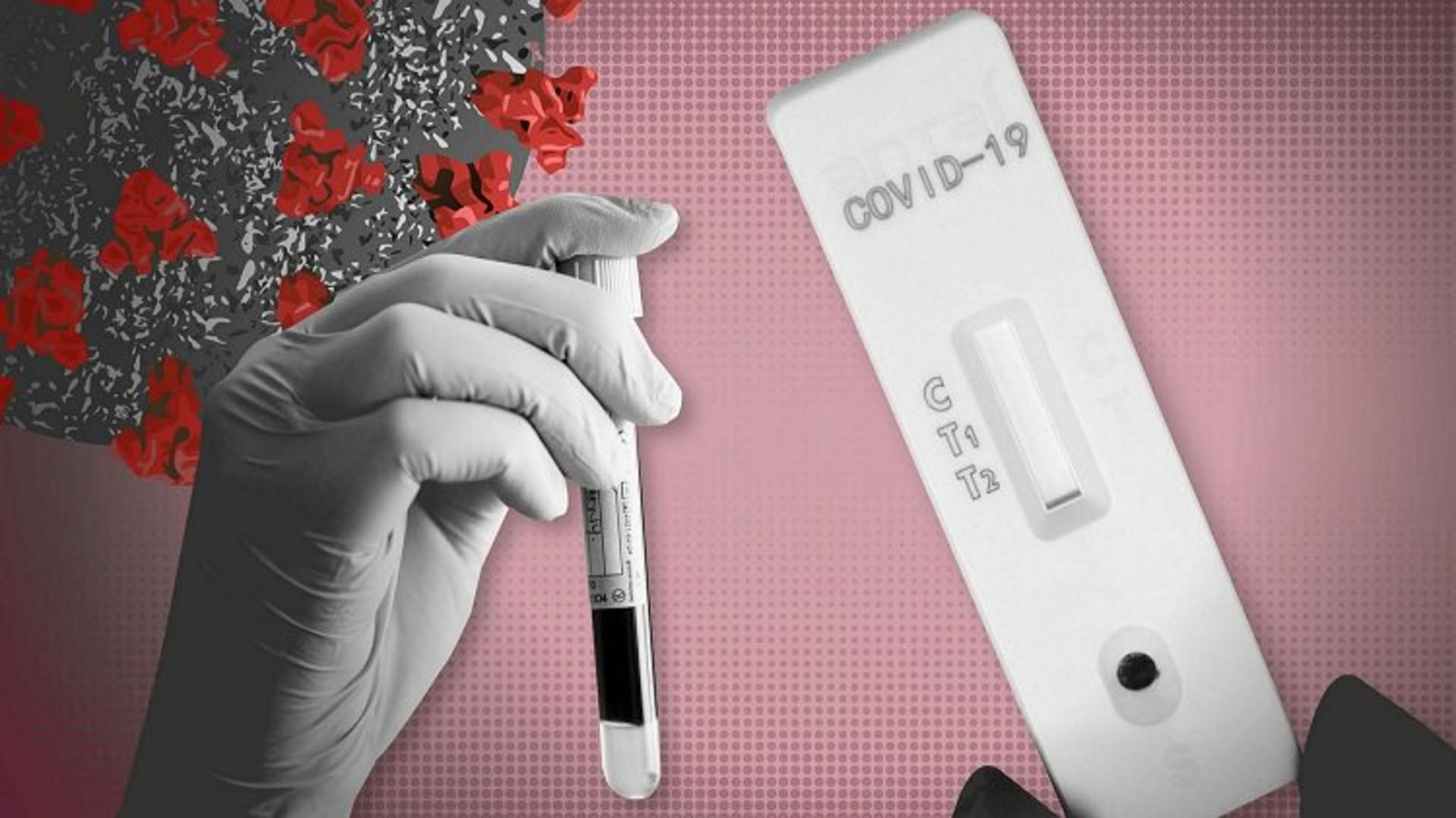 تست آنتی بادی کرونا