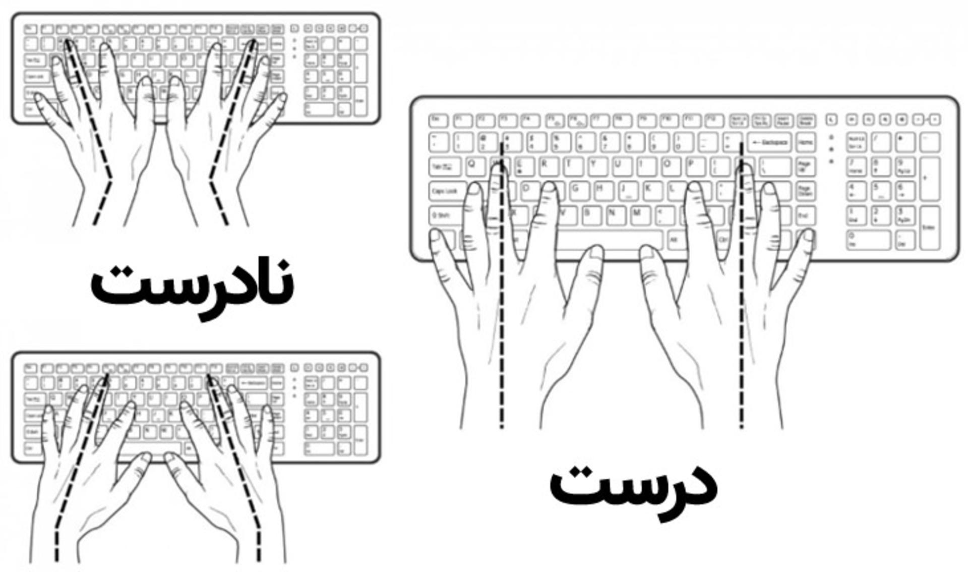 استفاده صحیح از کیبورد - سندروم تونل کارپال