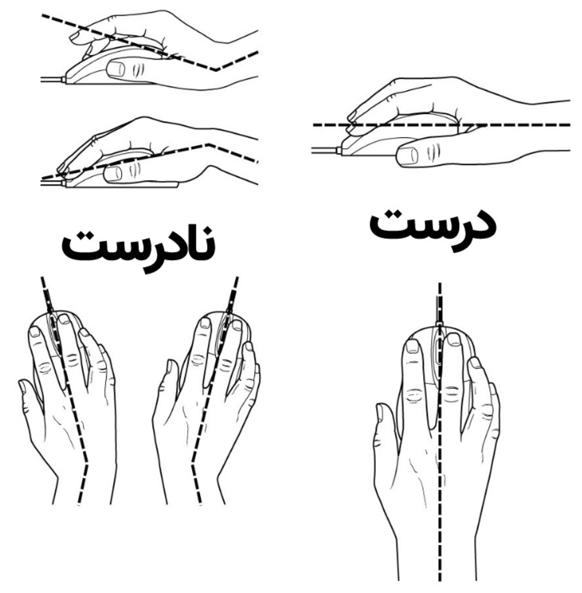 استفاده صحیح از ماوس - سندروم تونل کارپال