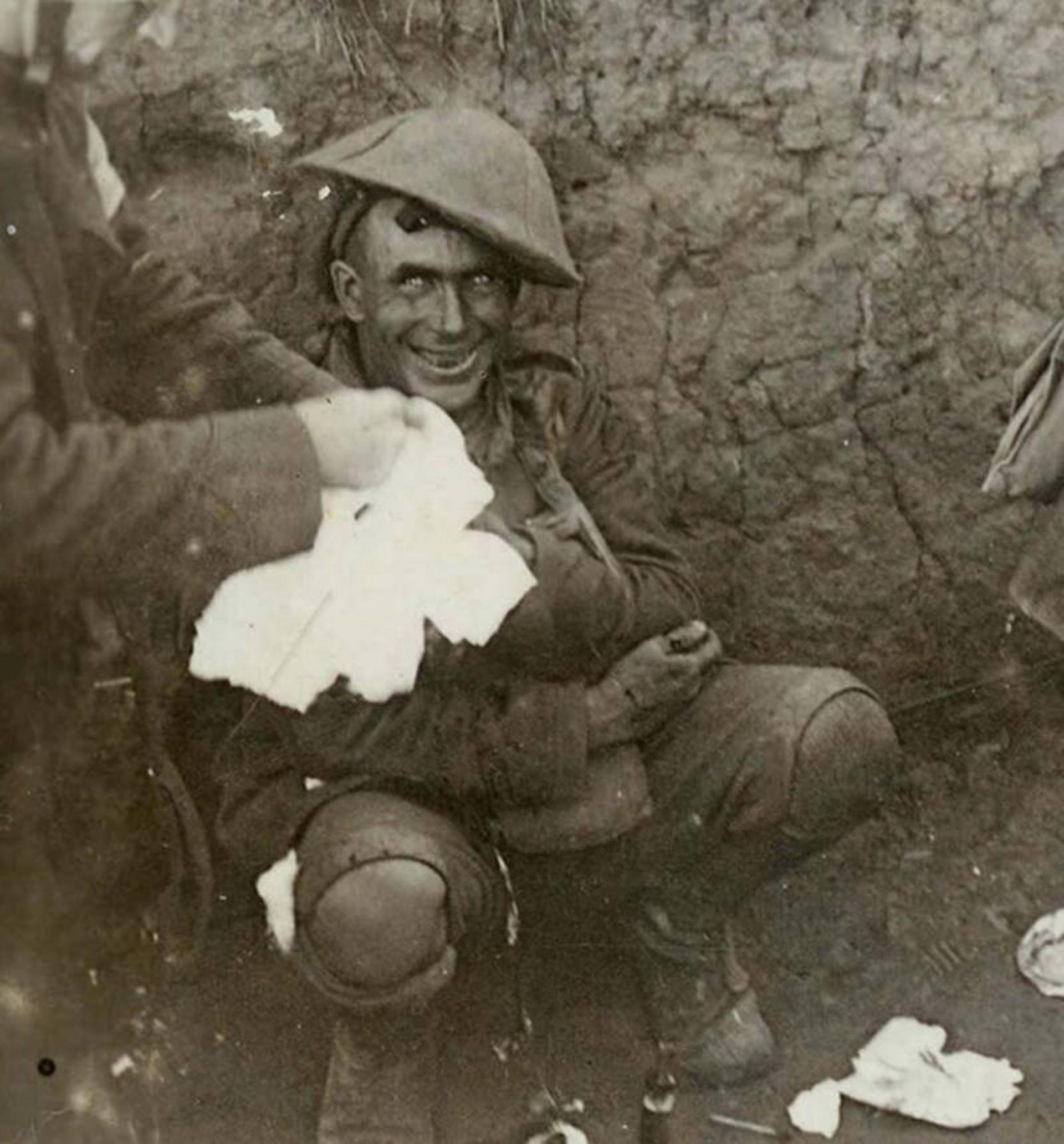 شوك انفجار سربازی در طول جنگ جهانی اول