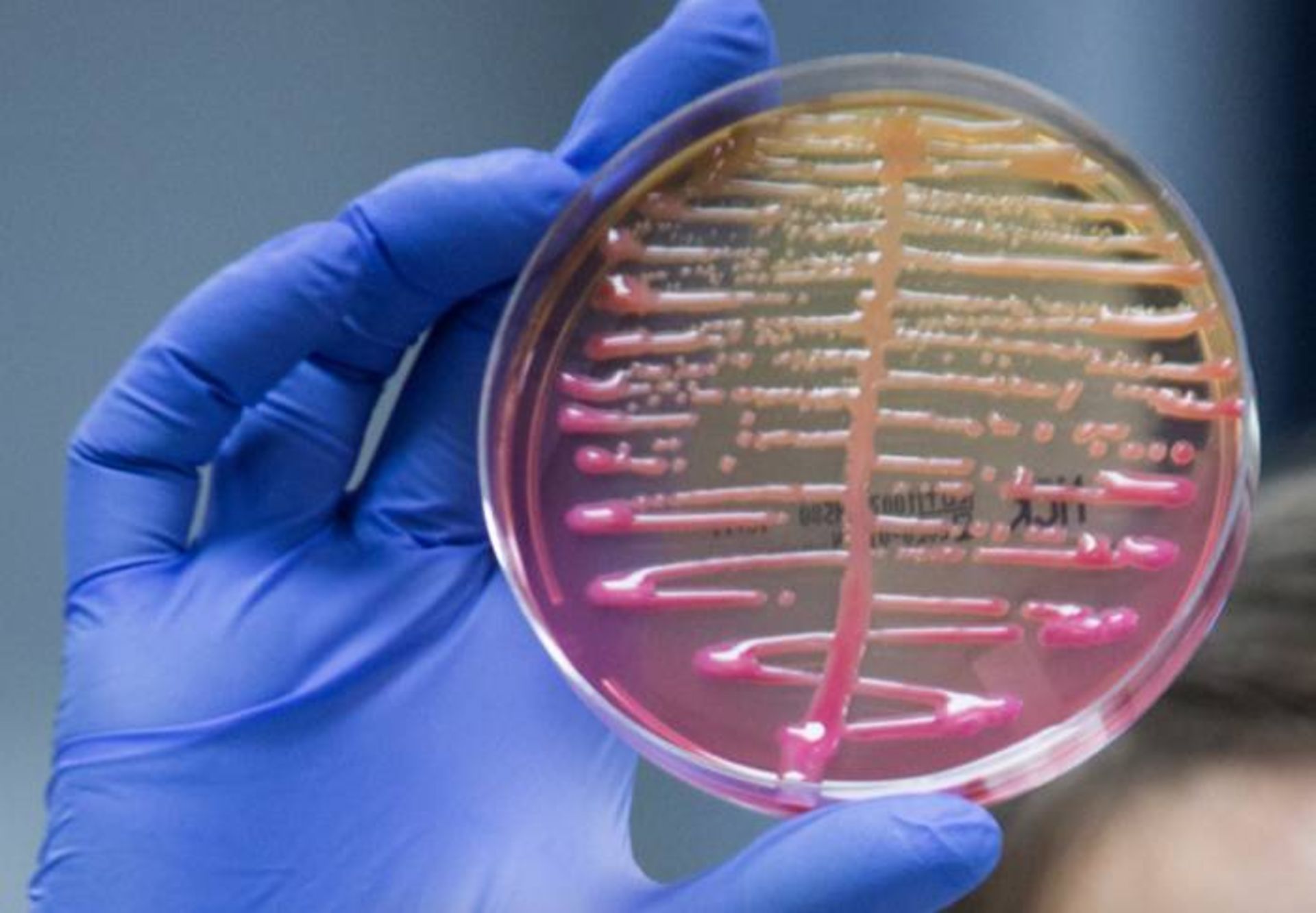 کشت کلبسیلا پنومونیه / Klebsiella pneumoniae