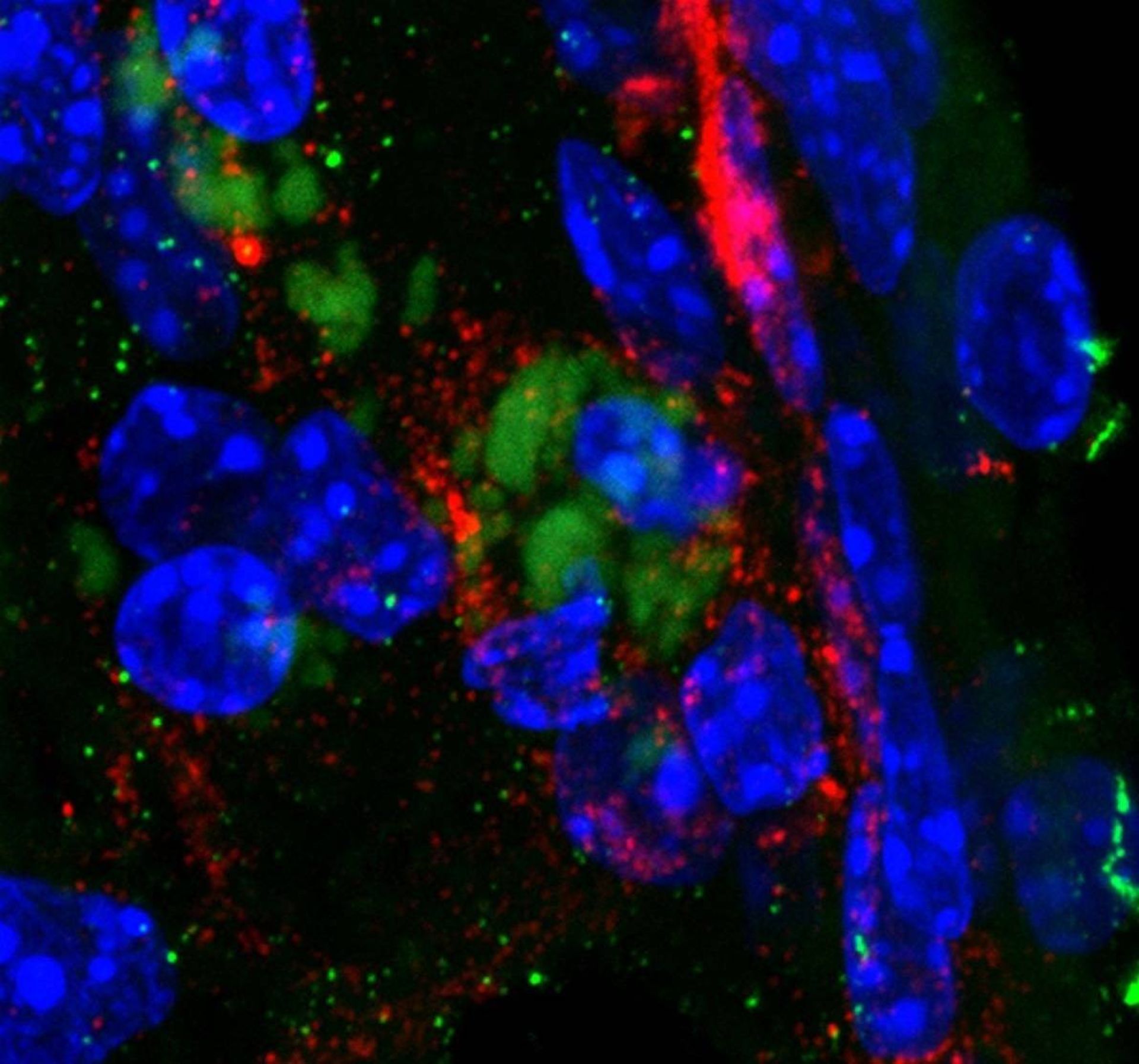 کلامیدیا پنومونی در مغز موش / Chlamydia pneumoniae