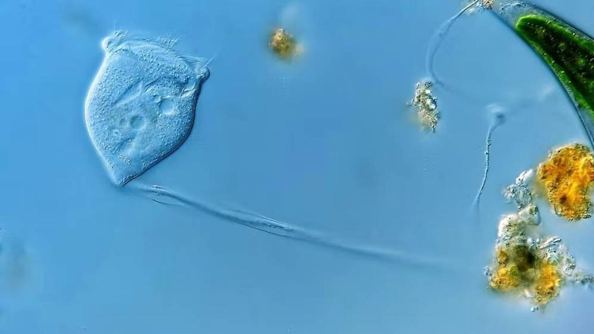 ورتیسلا / Vorticella