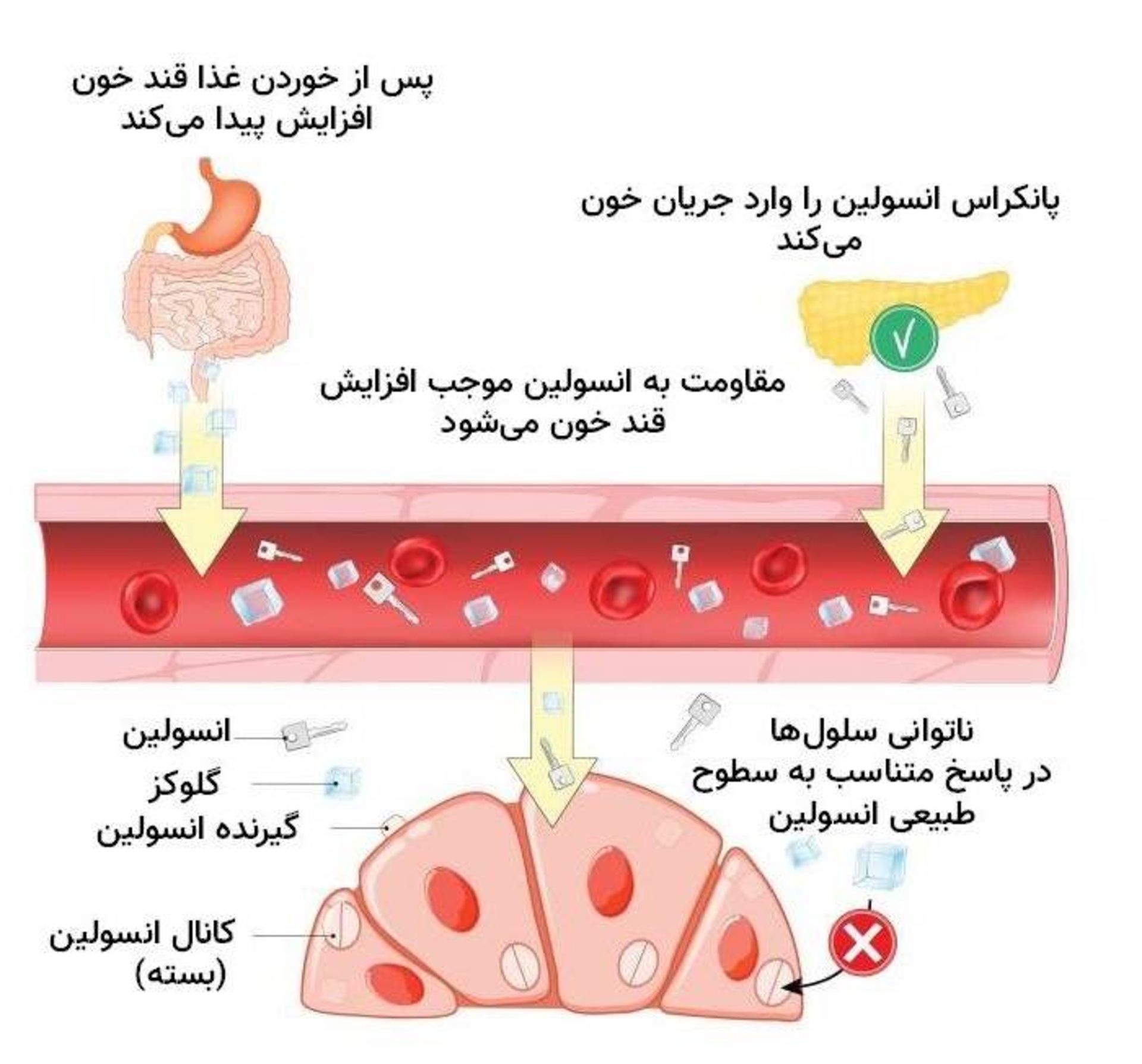 مقاومت به انسولین / Insulin Resistance