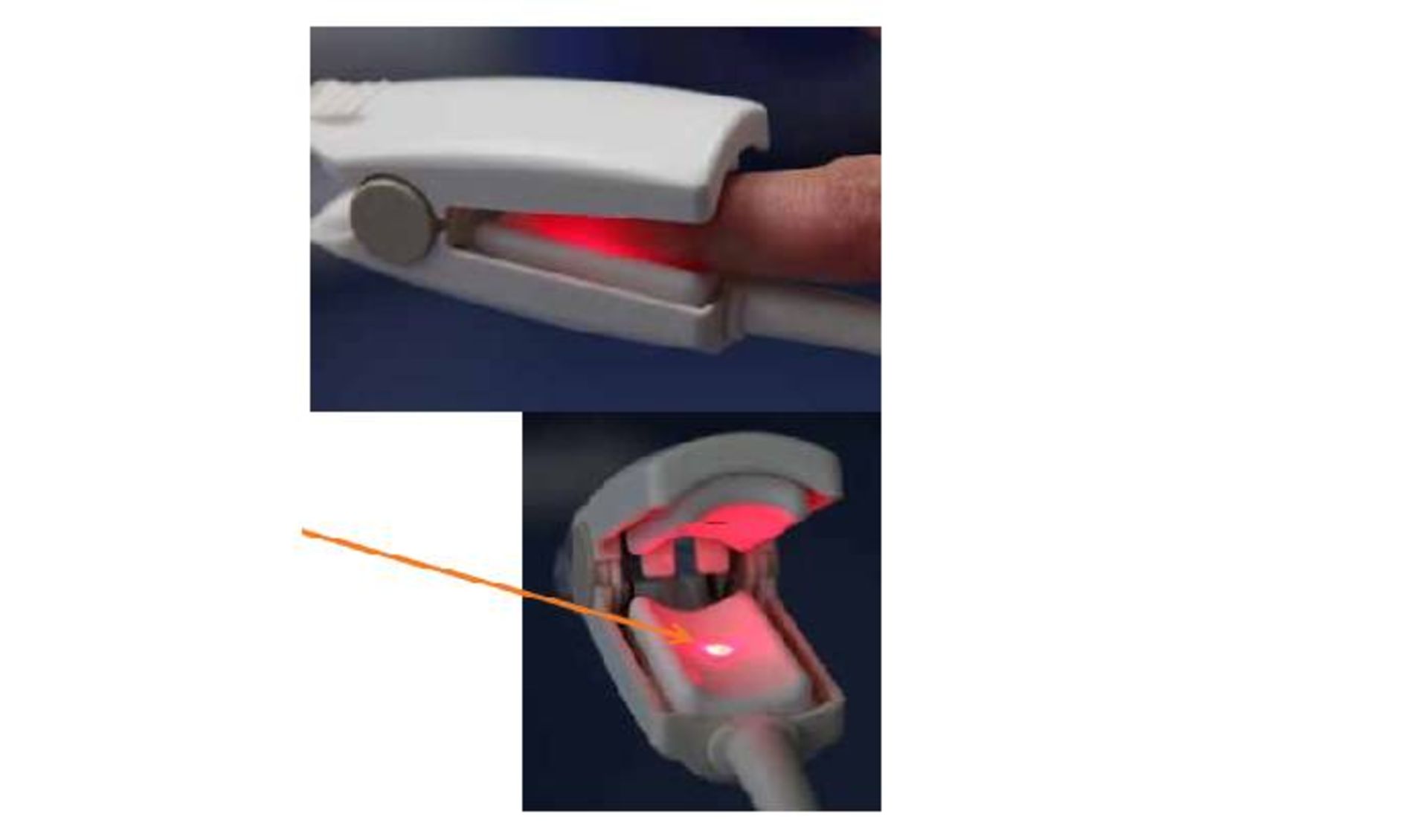 پالس اکسیمتر / pulse oximeter 