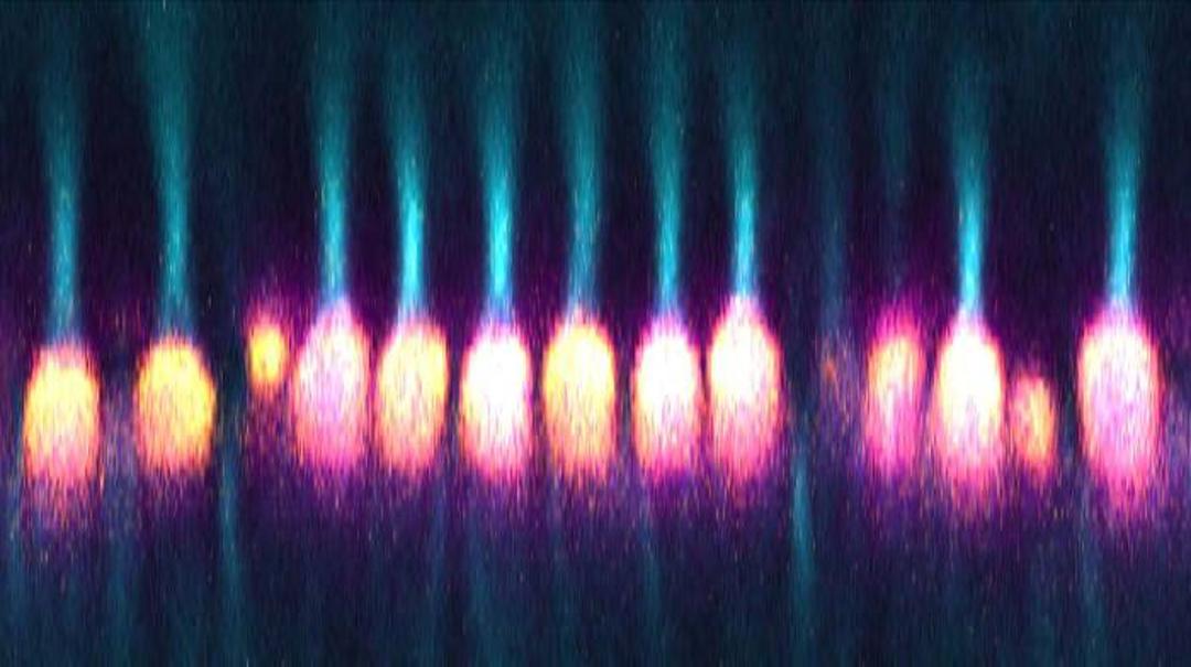 عمل میتوکندری در چشم به عنوان لنز / mitochondrial bundles 