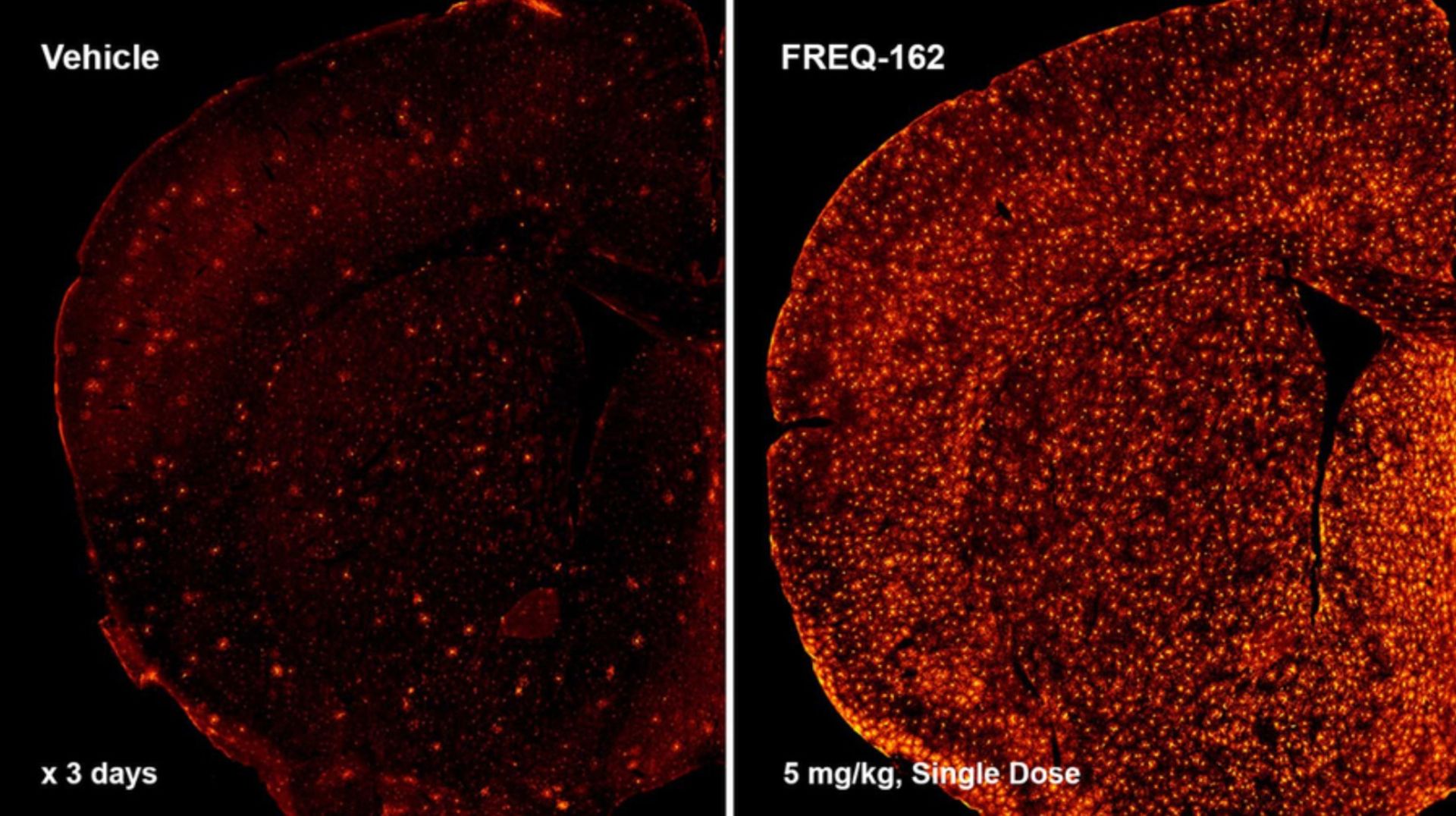 بهود شنوایی از دست رفته