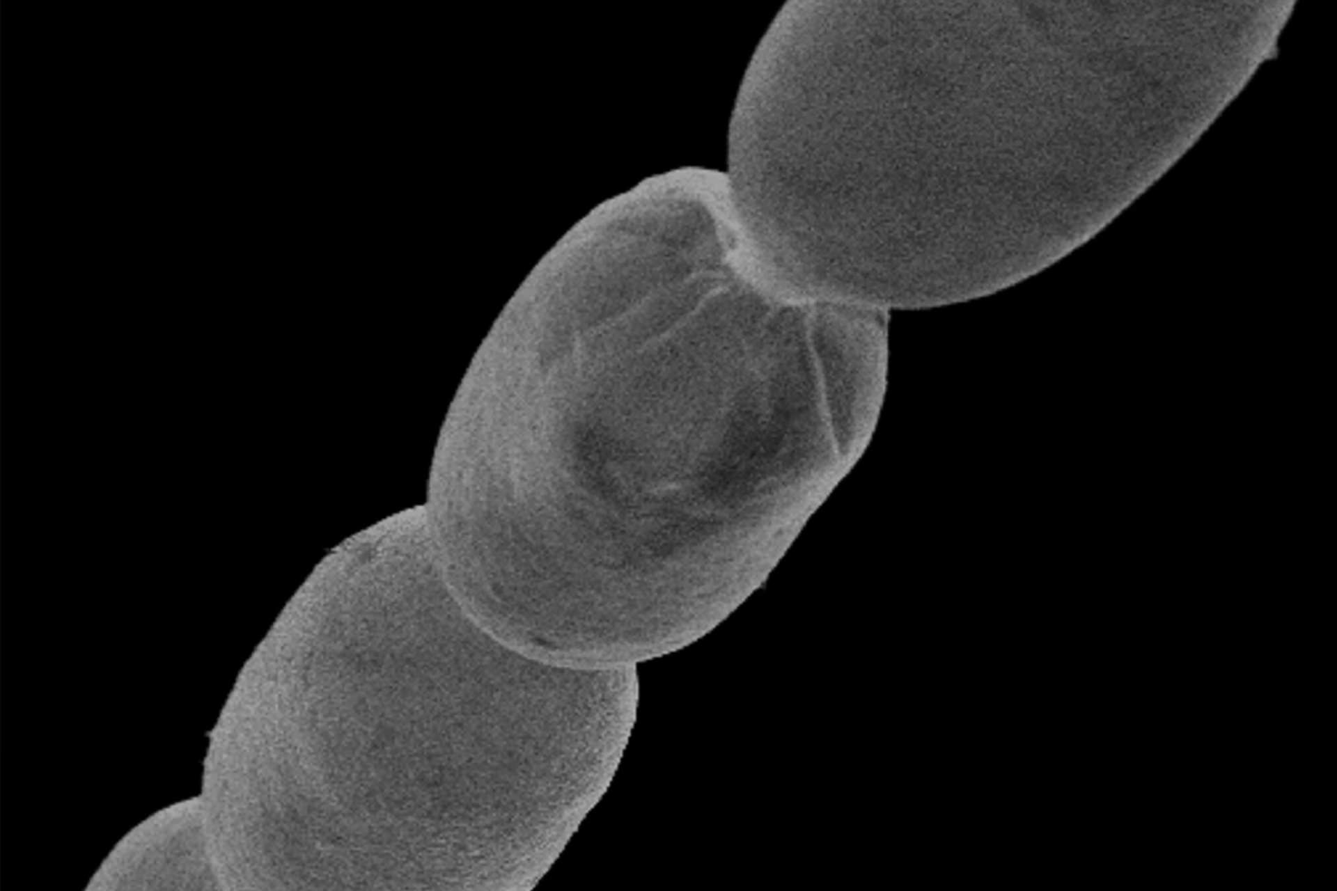 بزرگ ترین باکتری دنیا تیومارگاریتا مگنیفیک از نمای نزدیک