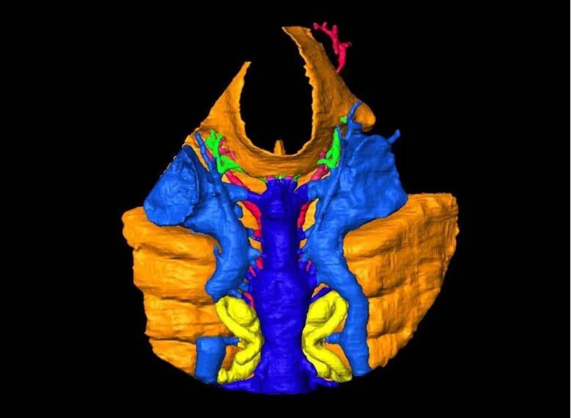 بازسازی فسیل / virtual reconstruction