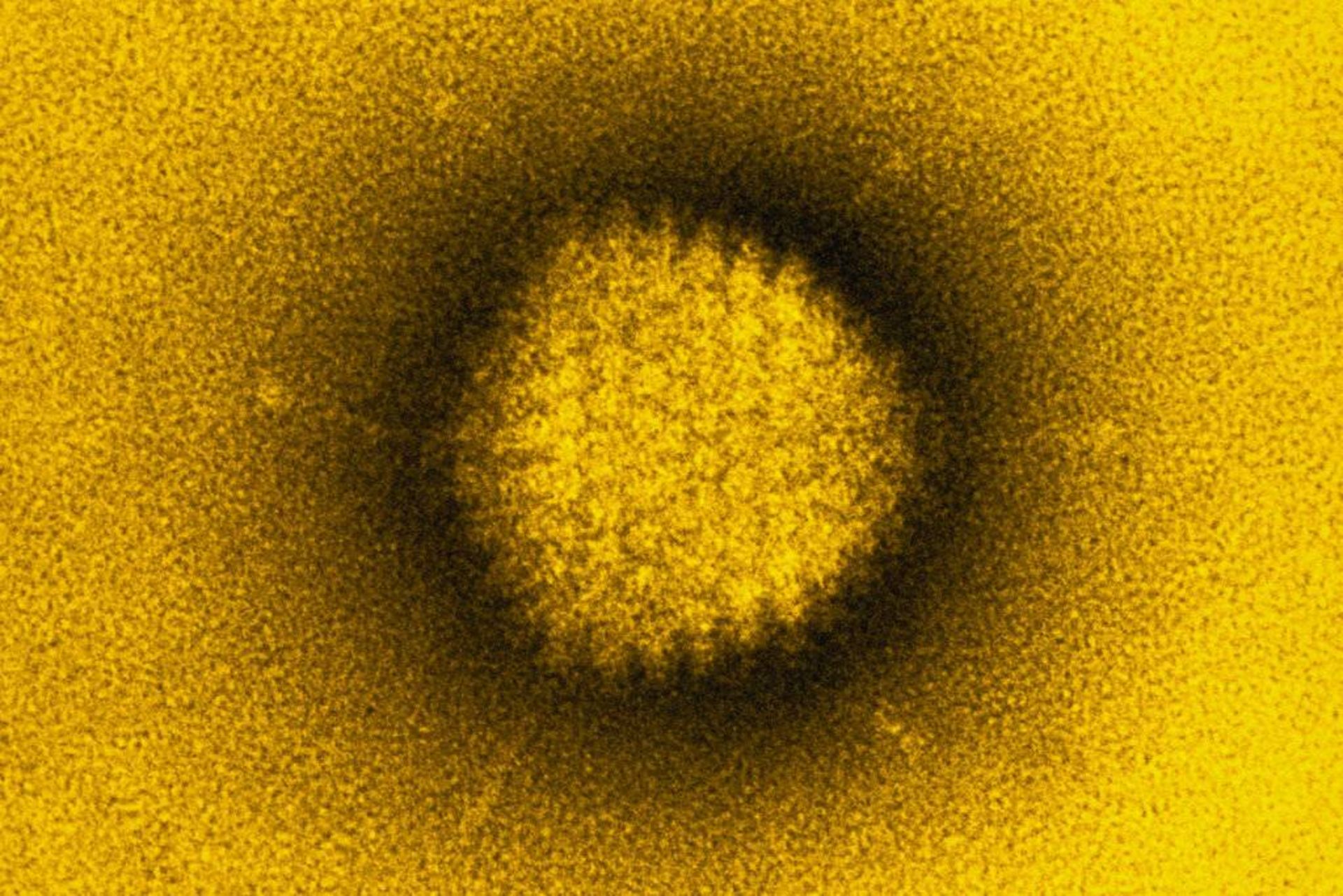 آدنوویروس / Adenovirus