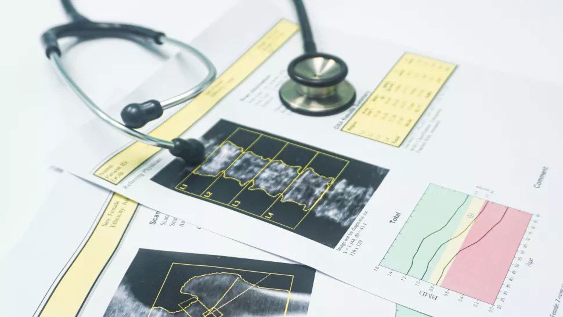 تست تراکم استخوان