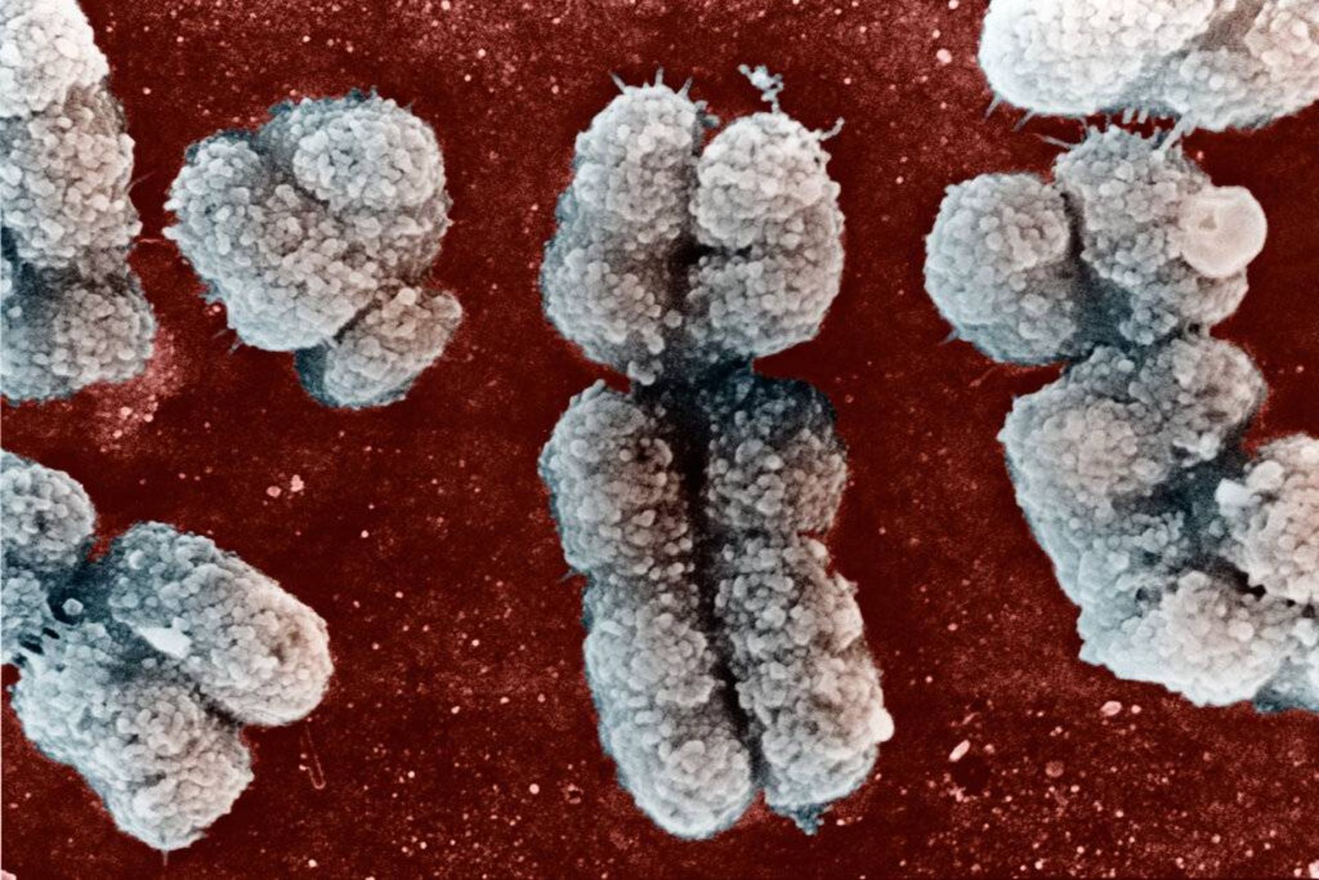 میکروگراف کروموزوم های انسان / micrograph of human chromosomes
